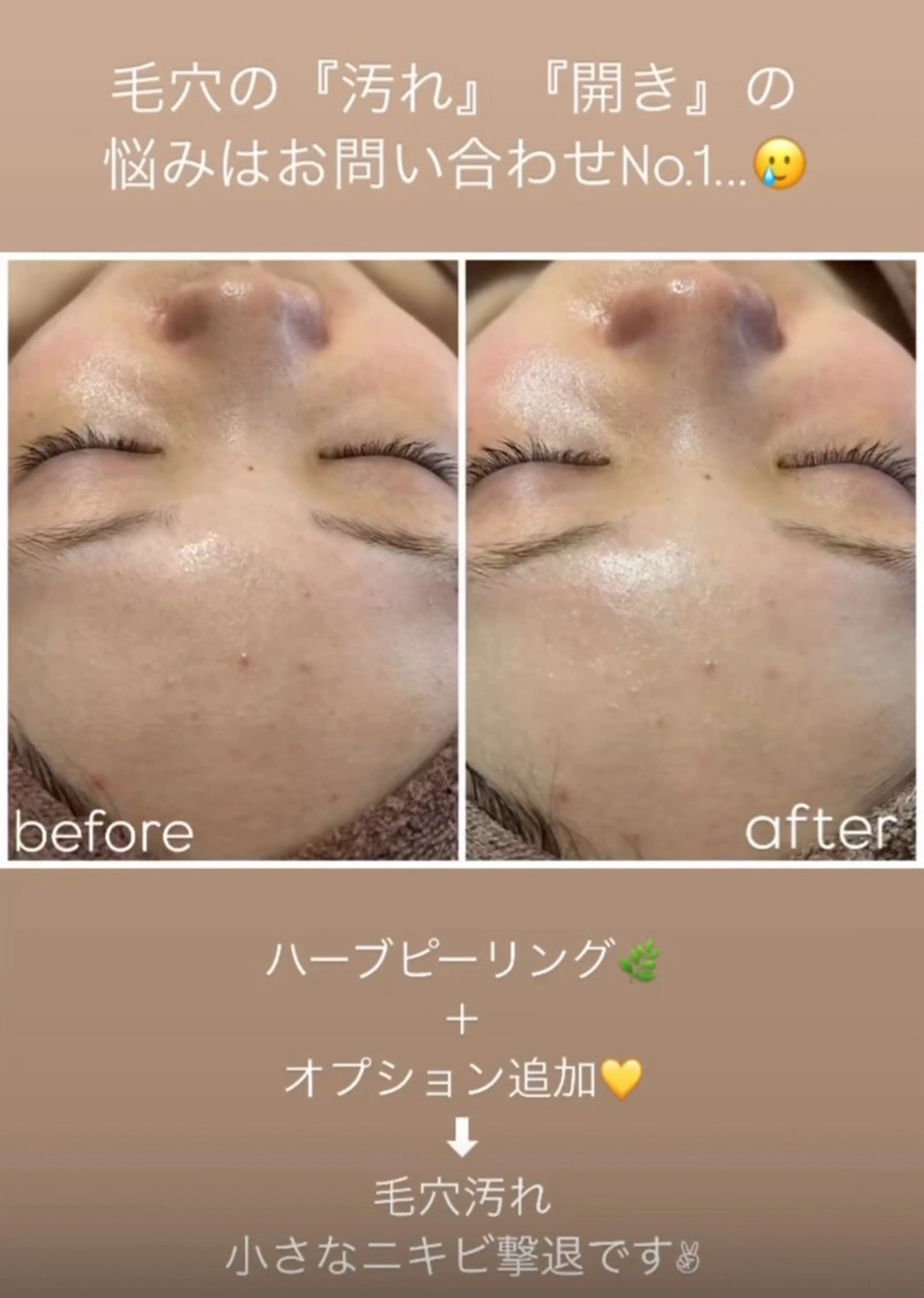 エステ WHITE AQUA 🌼柏店のエステ・リラクイメージ