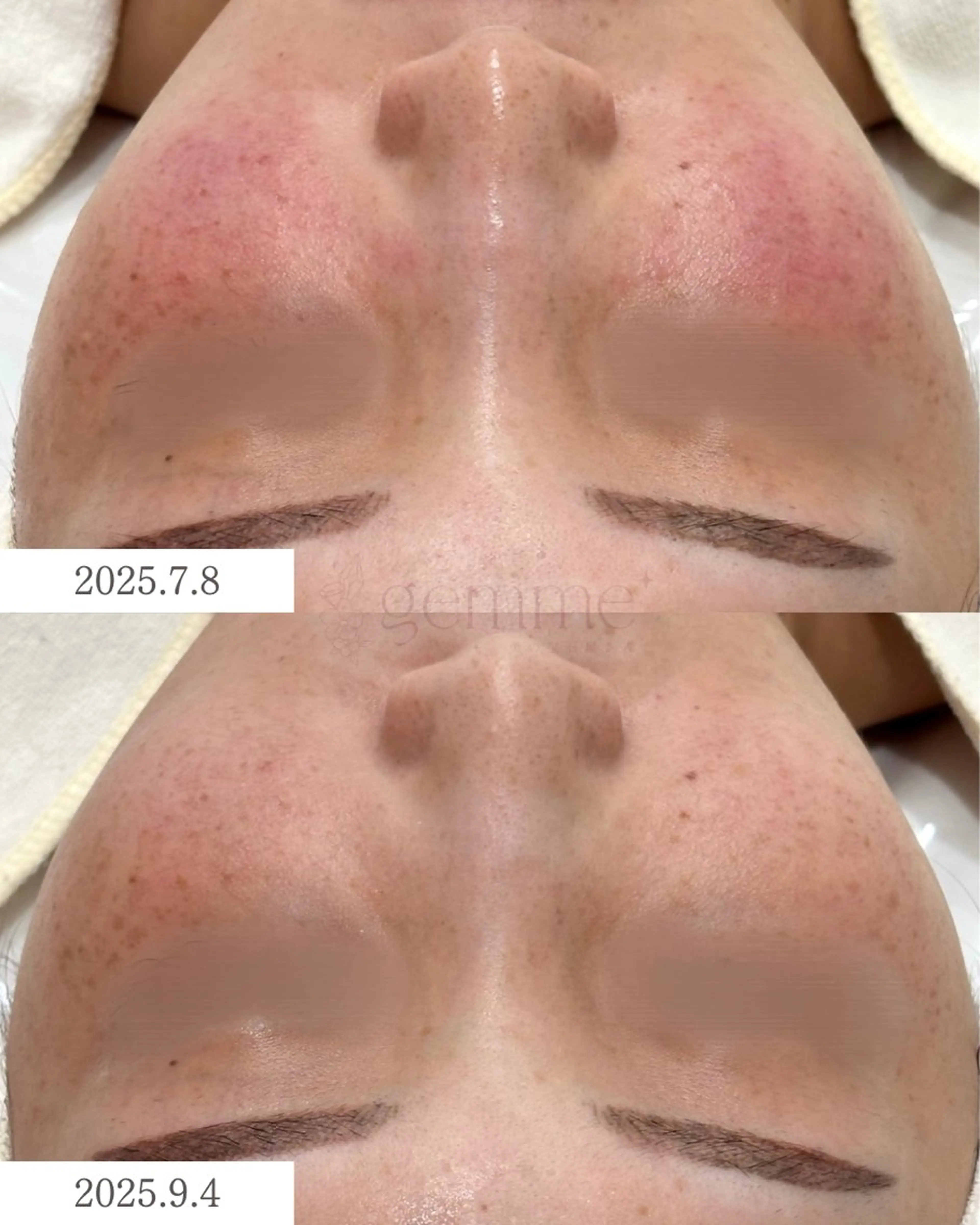 エステ リラク 美の宝石屋さん gemme【ジェム】所属・gemme -ジェム-のエステ・リラクイメージ