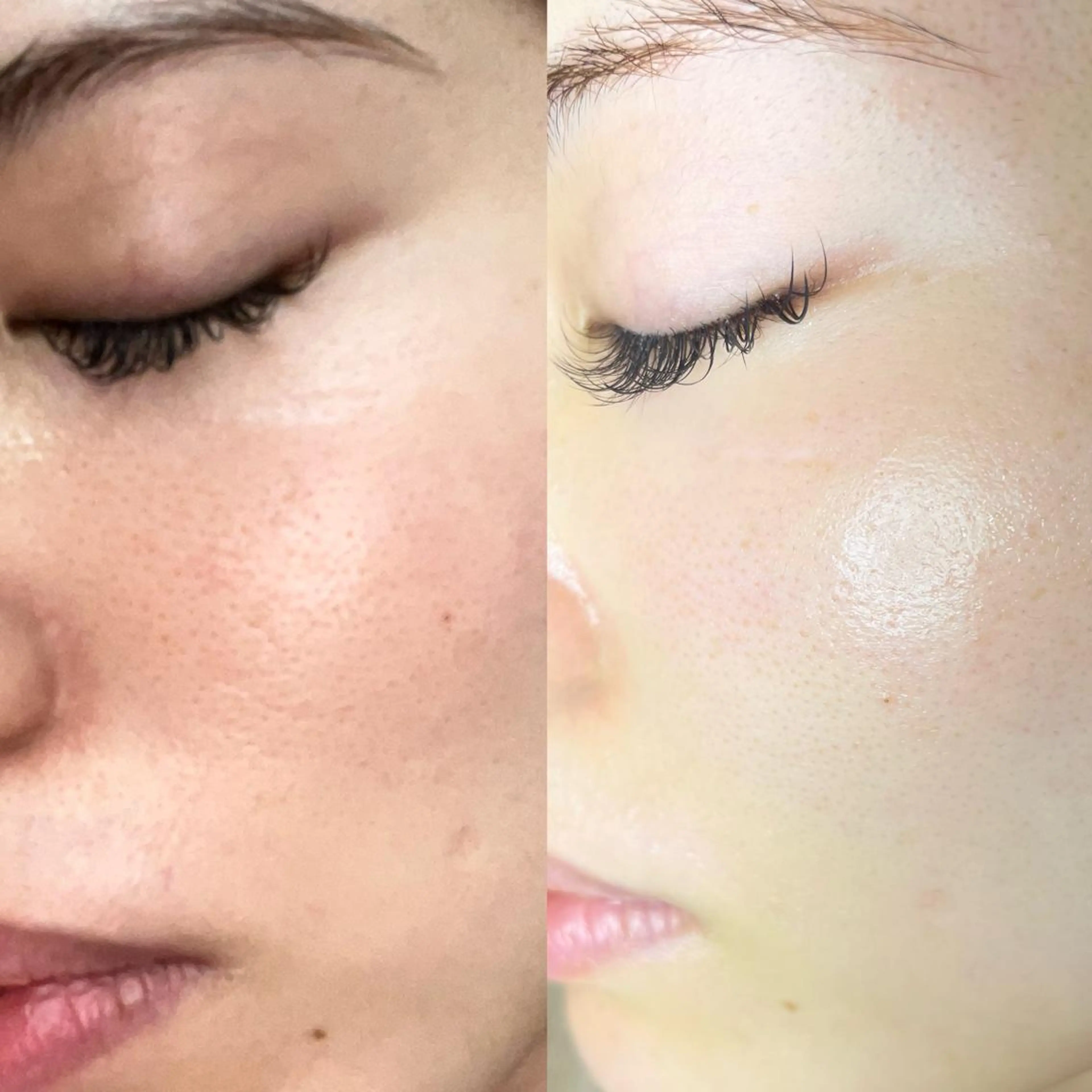 ハーブピーリング /毛穴ケア/脱毛/韓国ツヤ肌専門店【HARU.】所属・韓国ツヤ肌ピーリング ハーブ脱毛HARU.のエステ・リラクイメージ