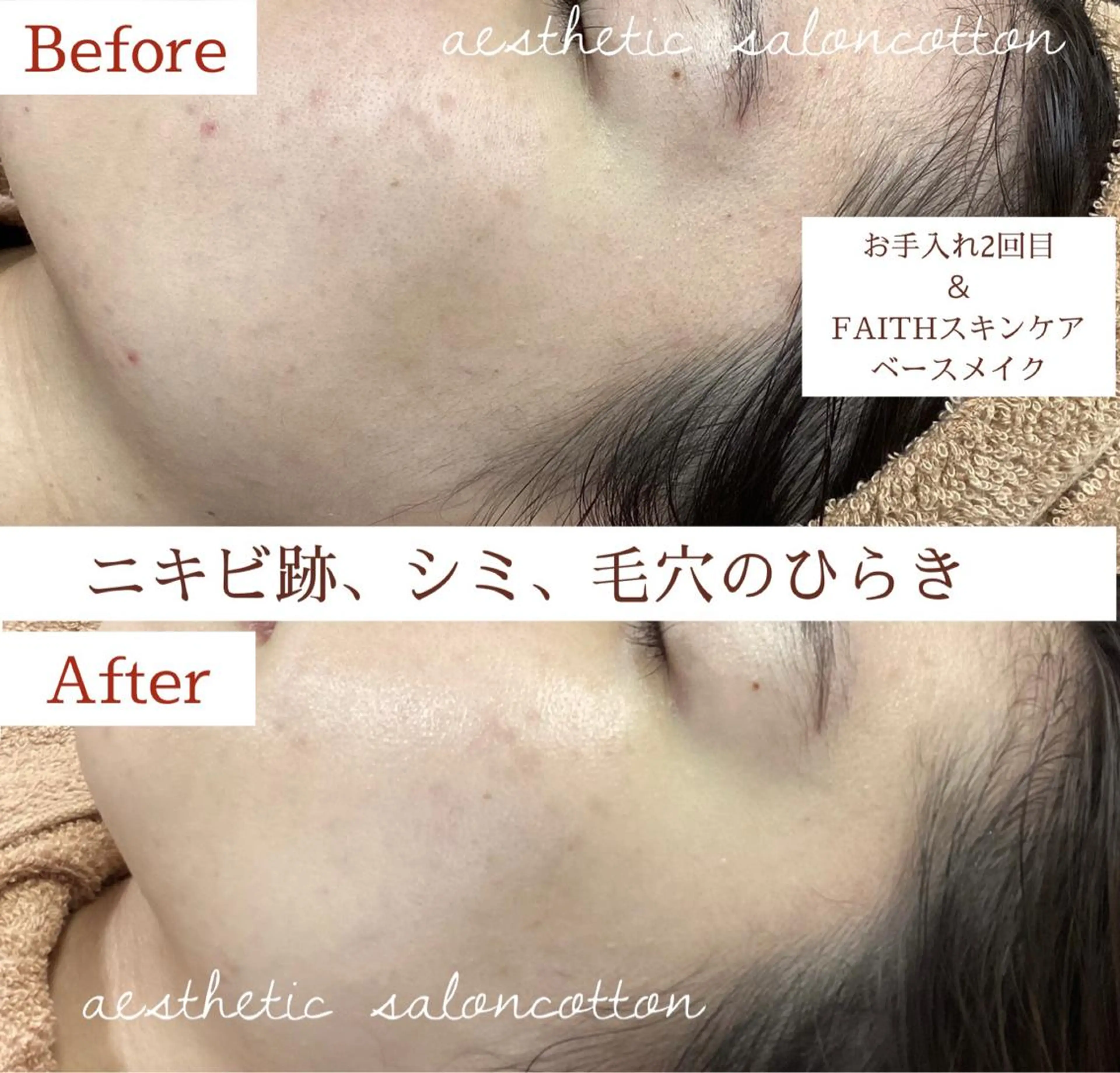 都度払い 肌質改善専門サロンのエステ・リラクイメージ