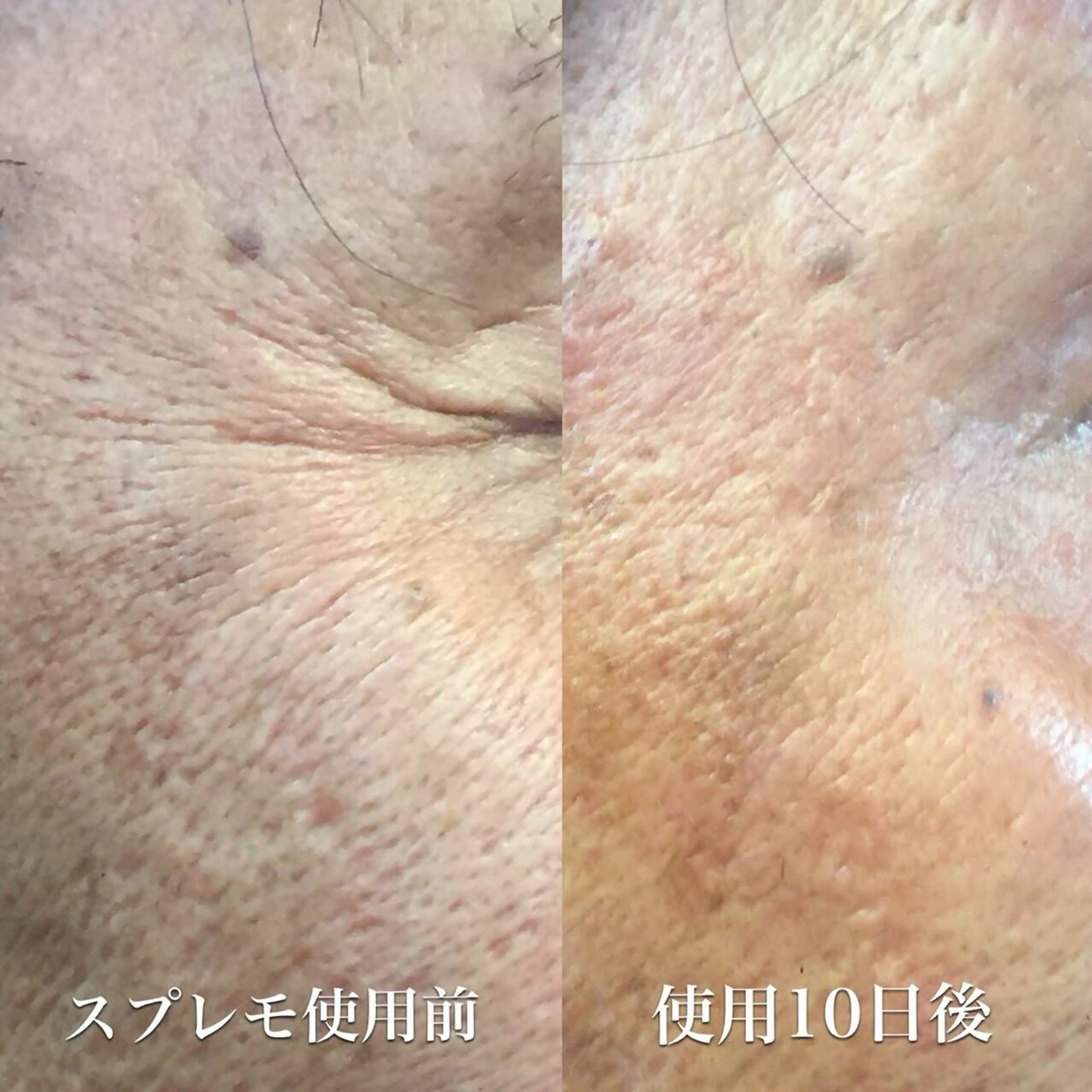 オールハンド フェイシャルのエステ・リラクイメージ