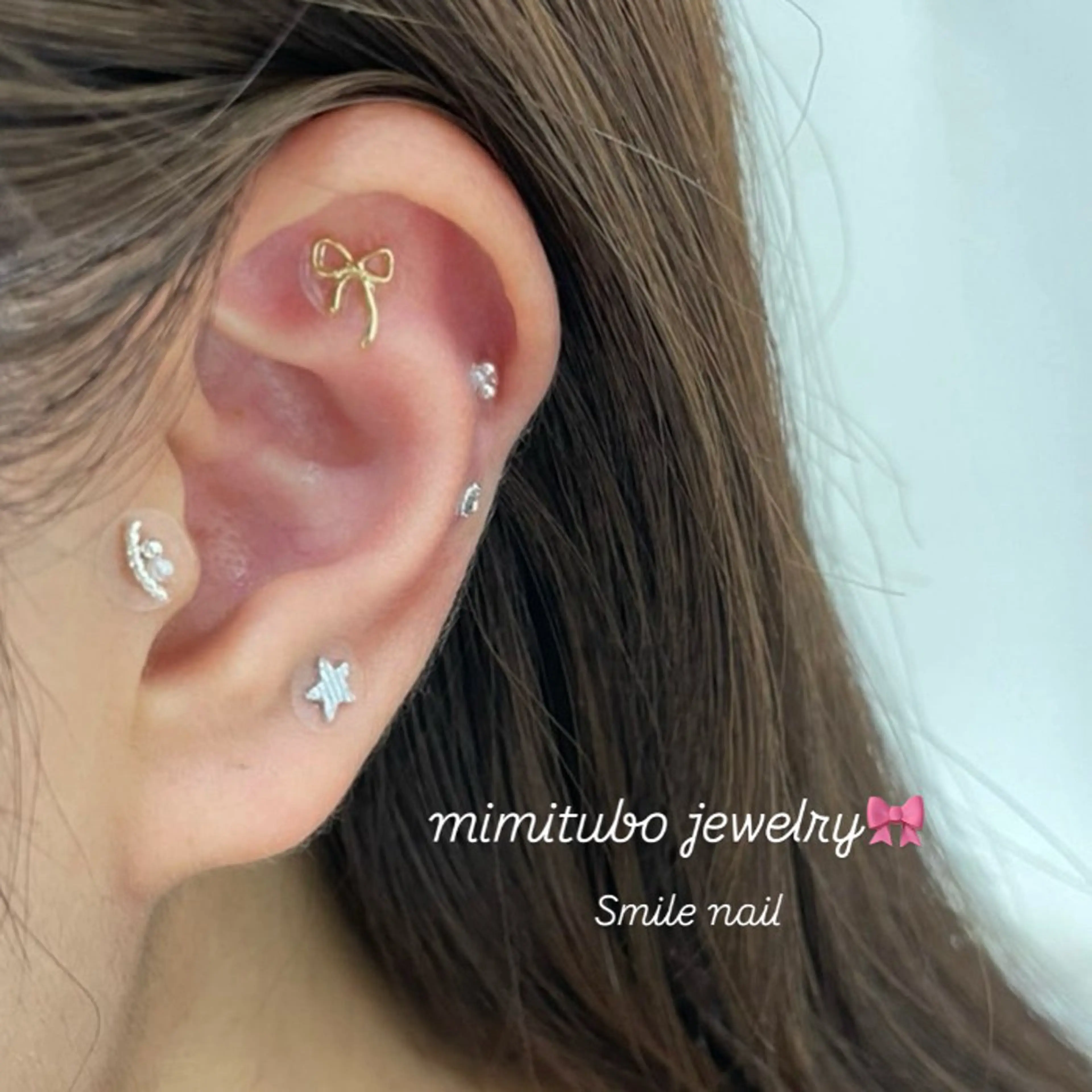 smileskin 京都／meguのその他イメージ