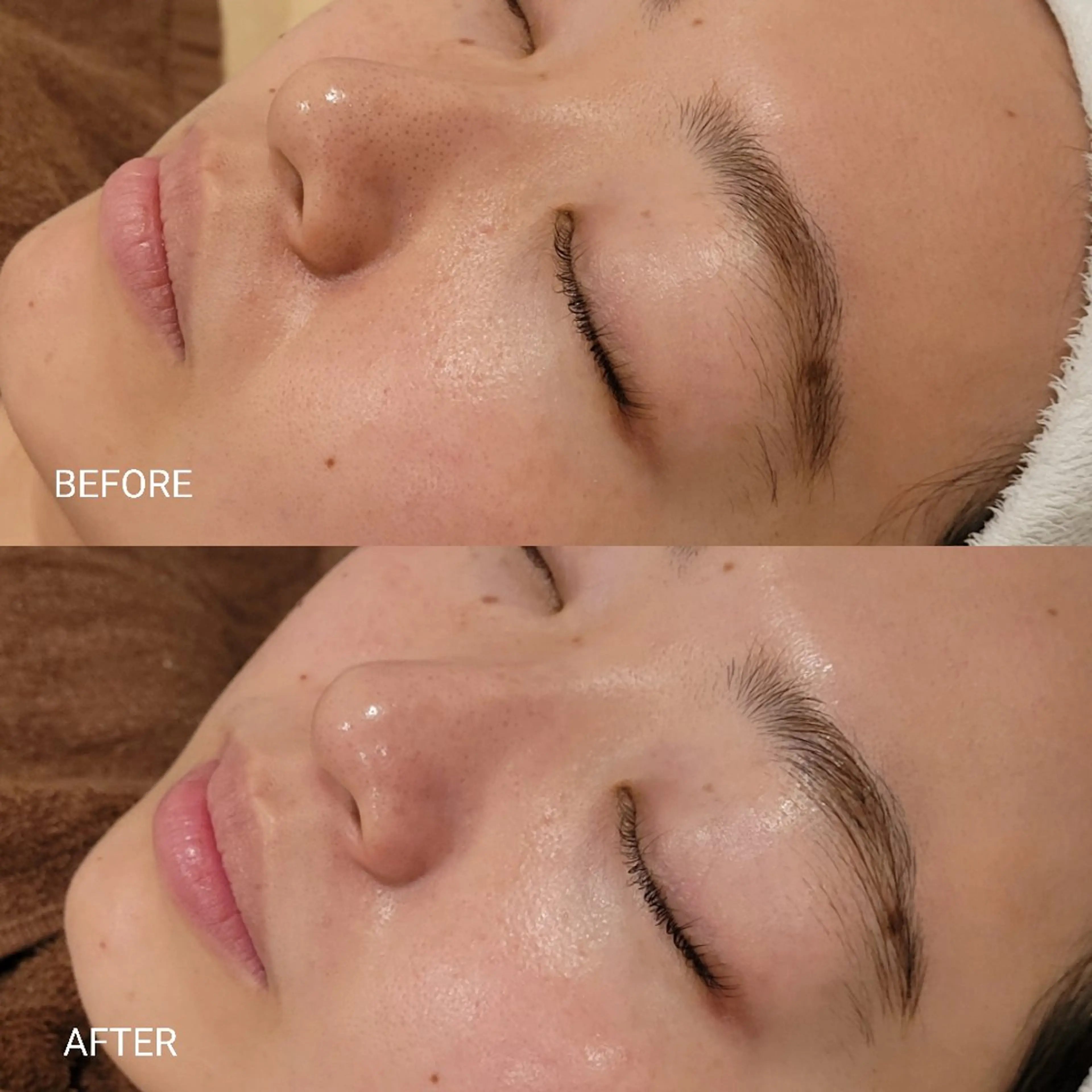 エステ 毛穴/肌管理/痩身/ ボディケア/satoのエステ・リラクイメージ