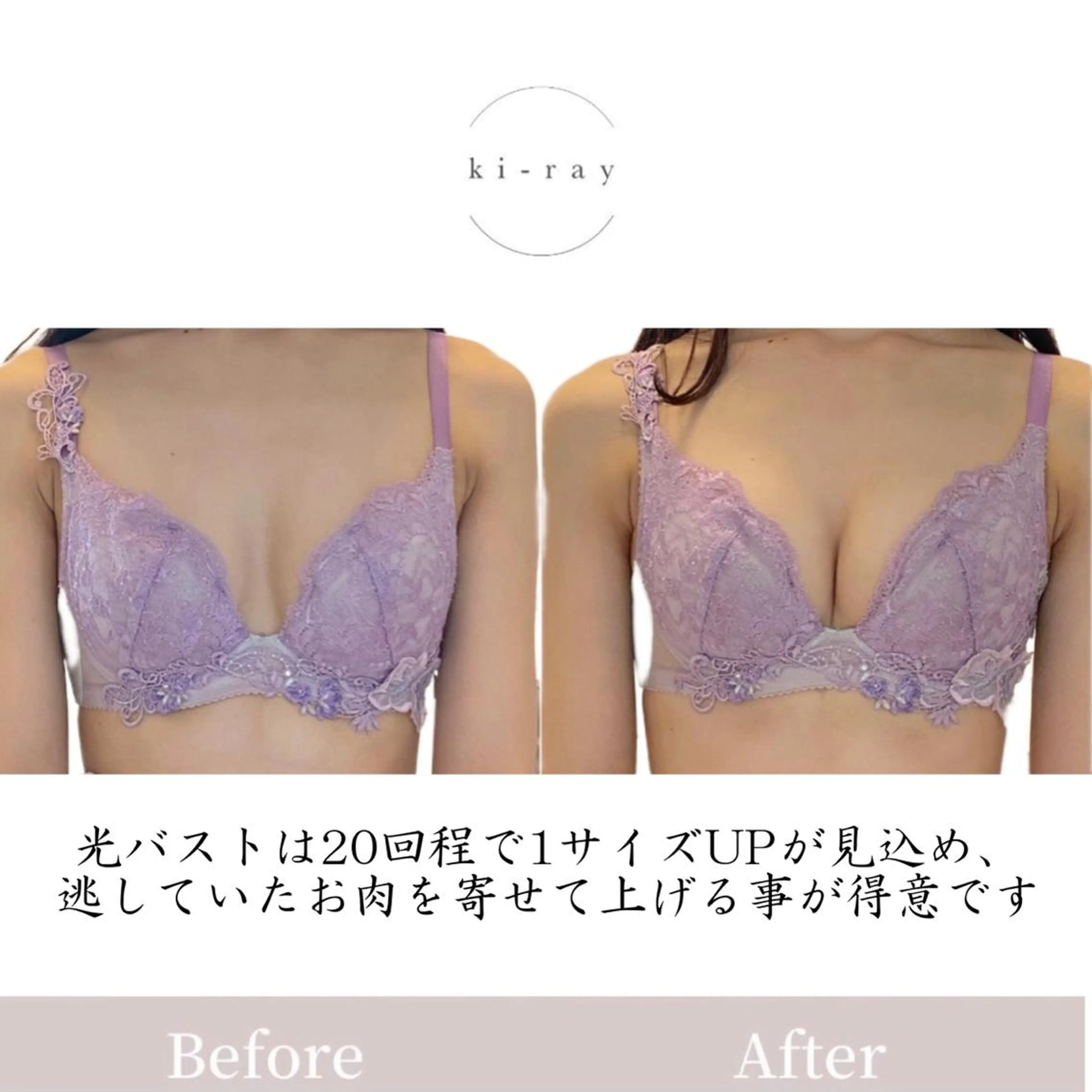 エステ 綺麗のひみつ グランプリ受賞店のエステ・リラクイメージ