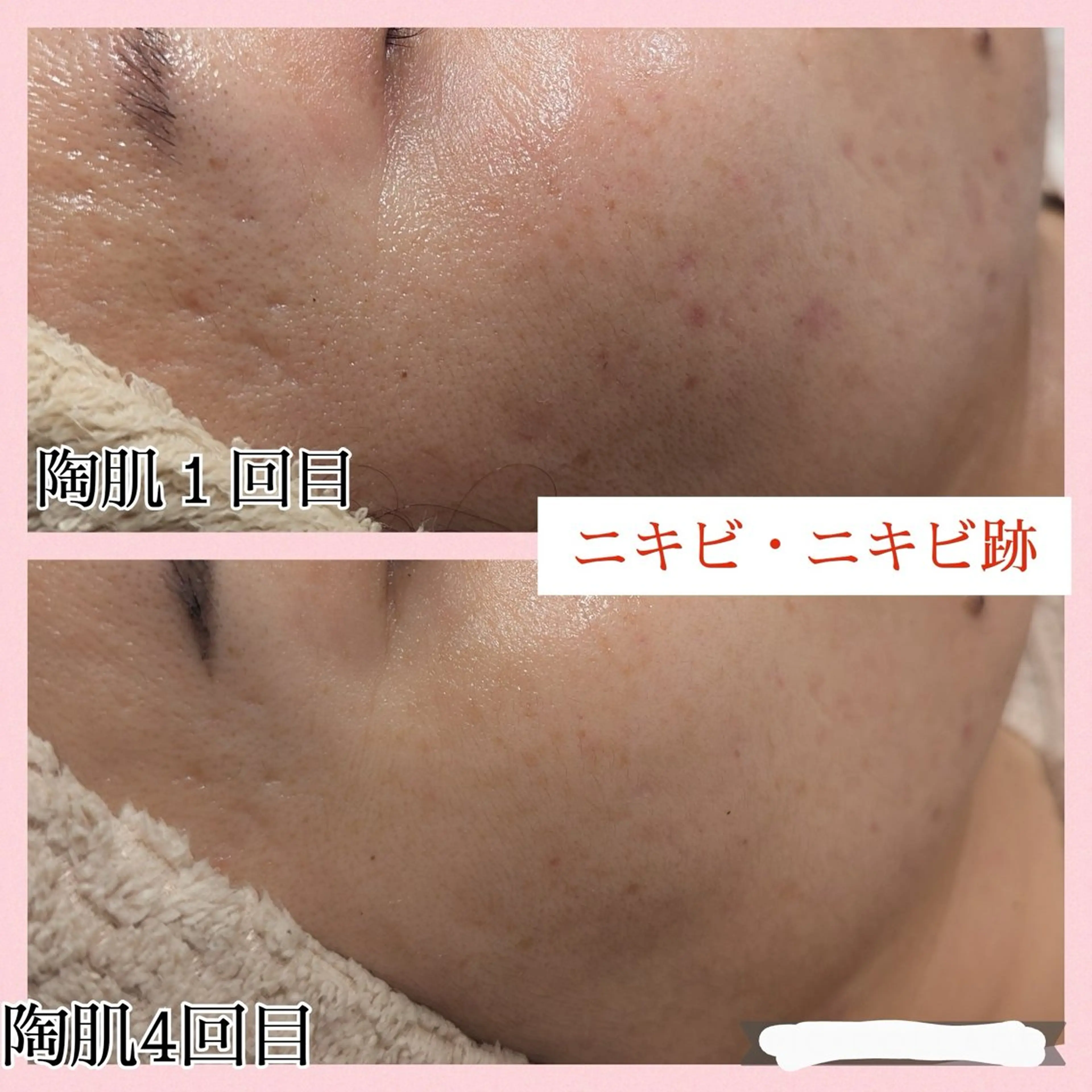 肌質改善プライベートサロンwith U所属・肌質改善サロン with Uのエステ・リラクイメージ