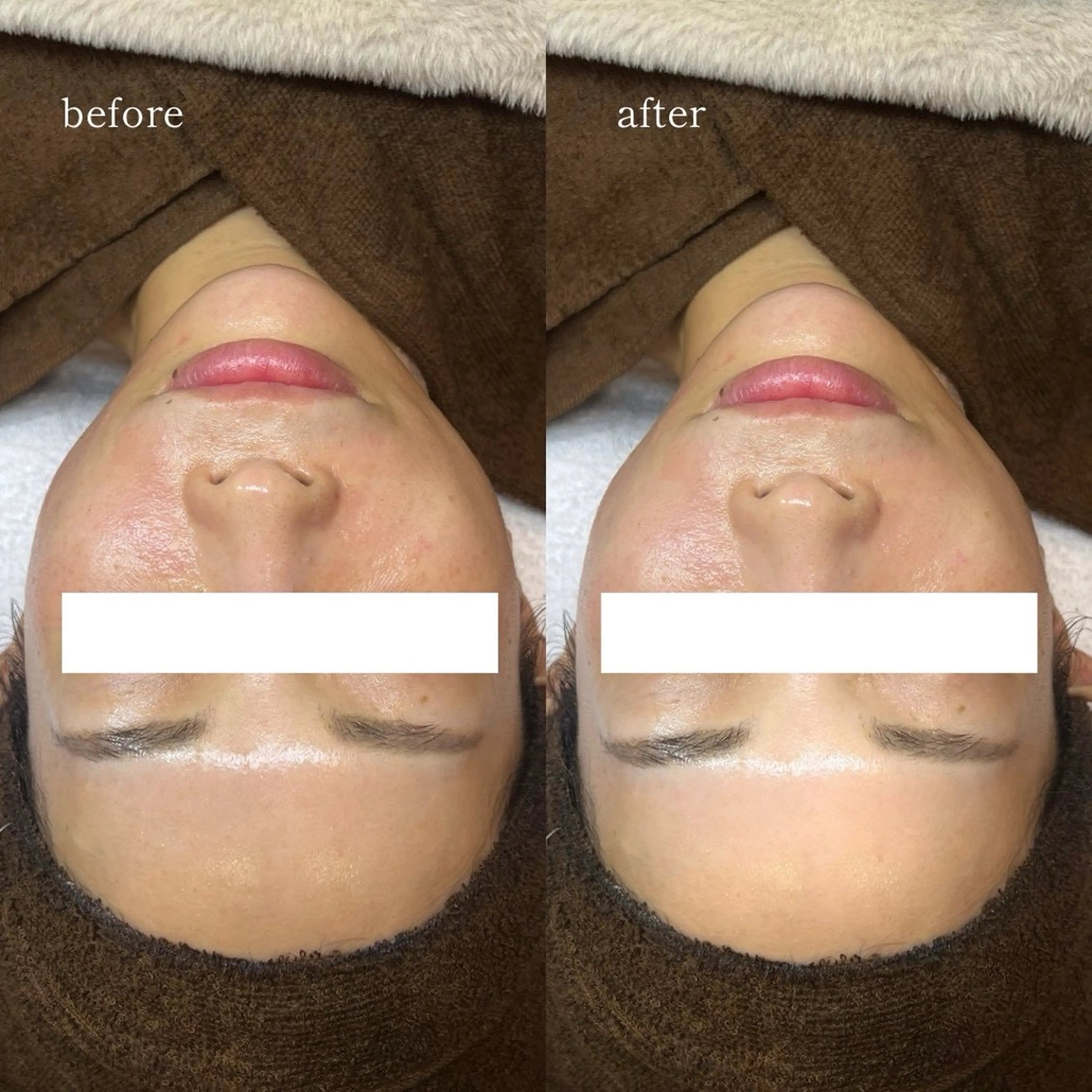 エステ 【韓国人肌製作所】 水光肌ならアーネストのエステ・リラクイメージ