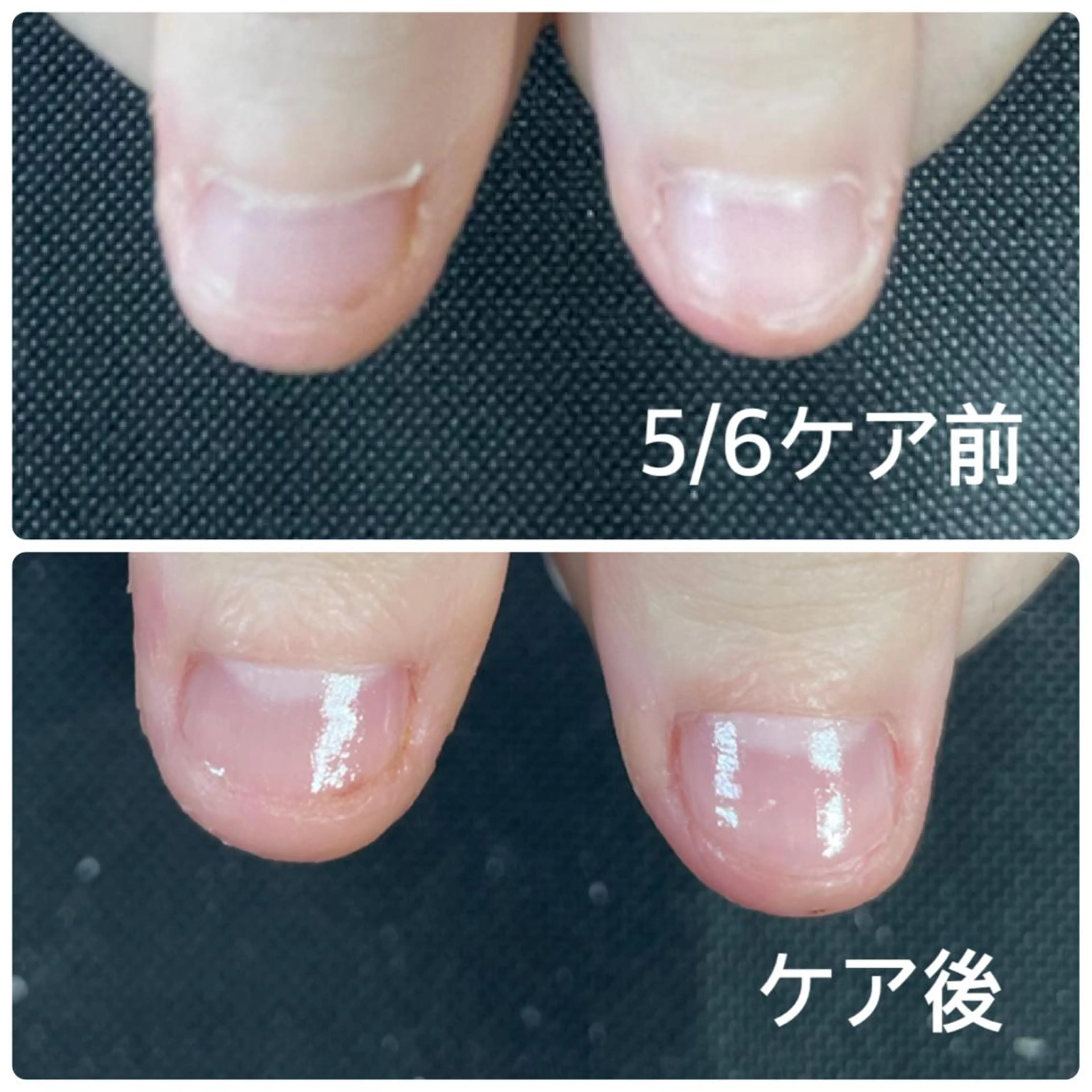 ネイル 奥園 良恵のネイルデザイン