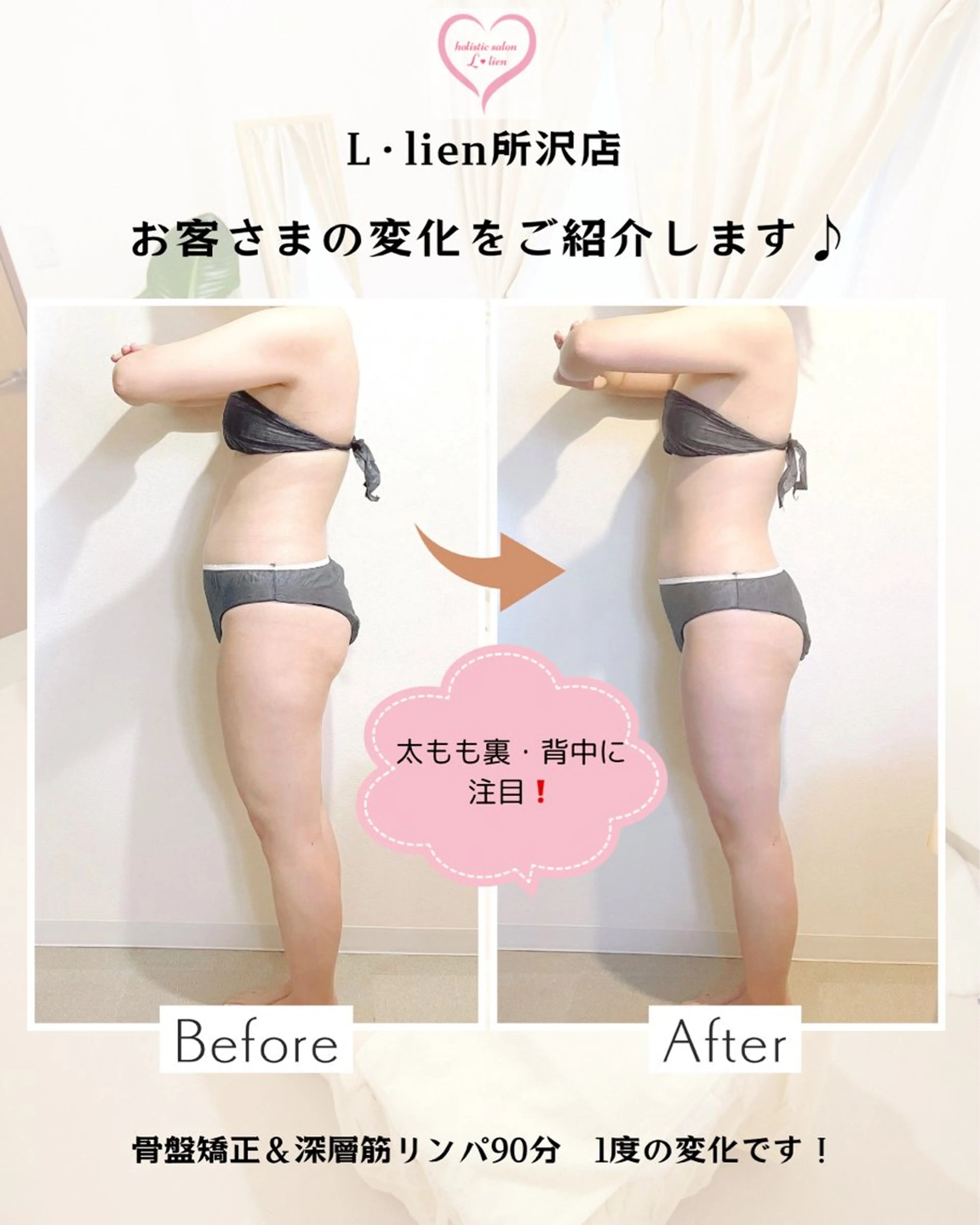 エステ 美容矯正＆深層筋リンパ専門L･lien（エル･リアン）所属・痩身/小顔/矯正 🌟TOMOEのエステ・リラクイメージ