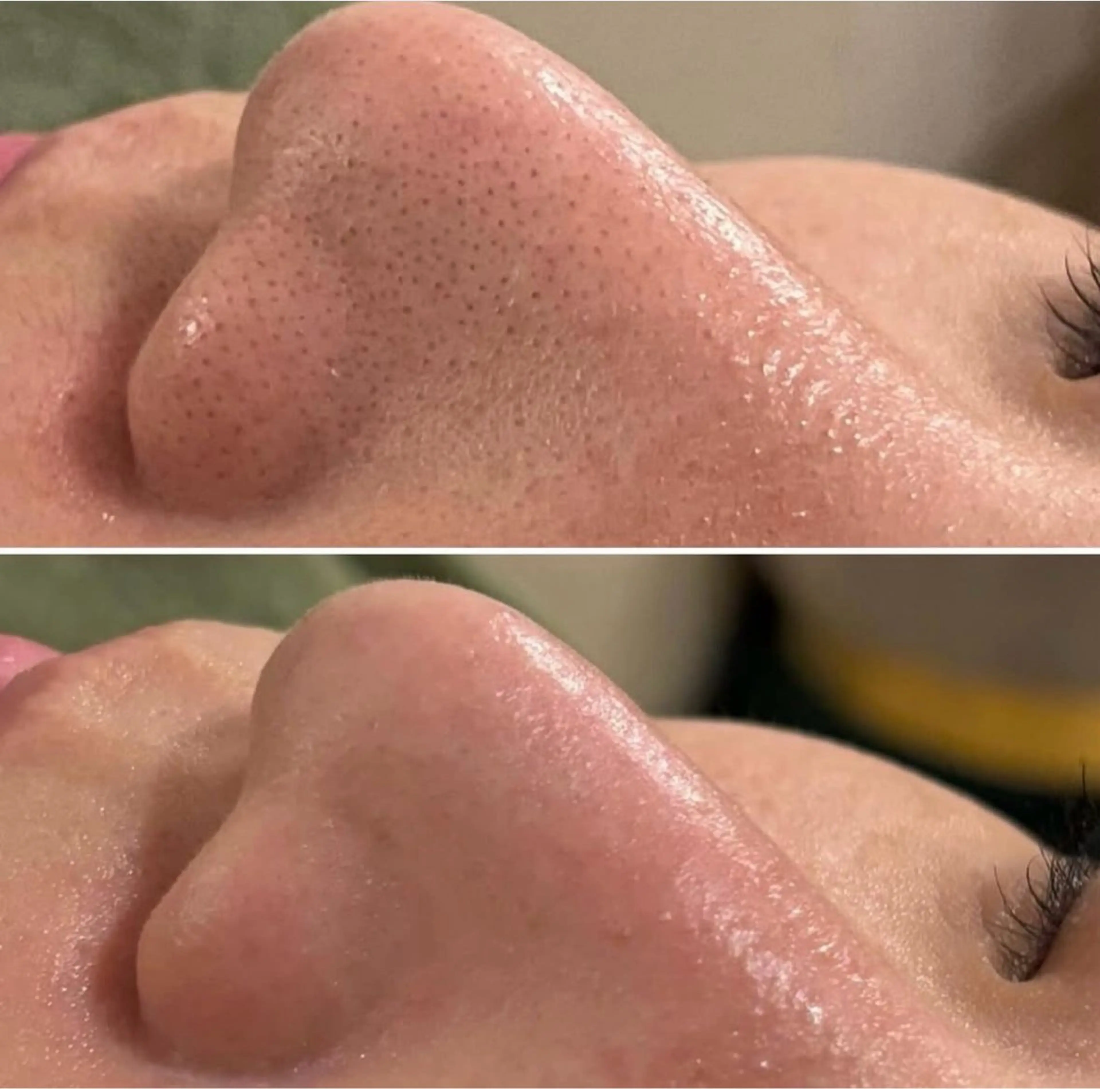 エステ A"-HILU(アーヒル)所属・A"-HILU （アーヒル)のエステ・リラクイメージ