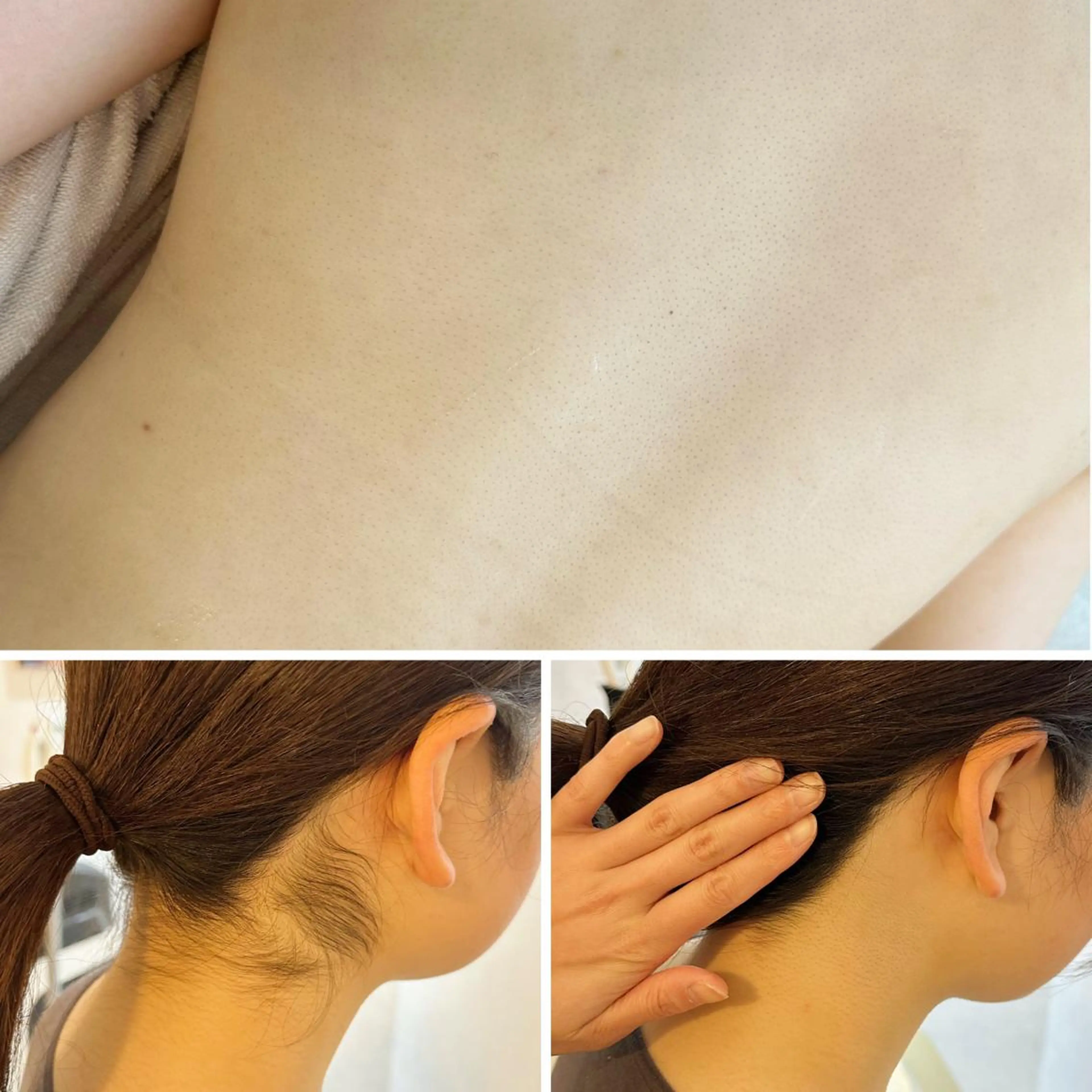 脱毛 うなじ脱毛/美肌脱毛 LABELのエステ・リラクイメージ