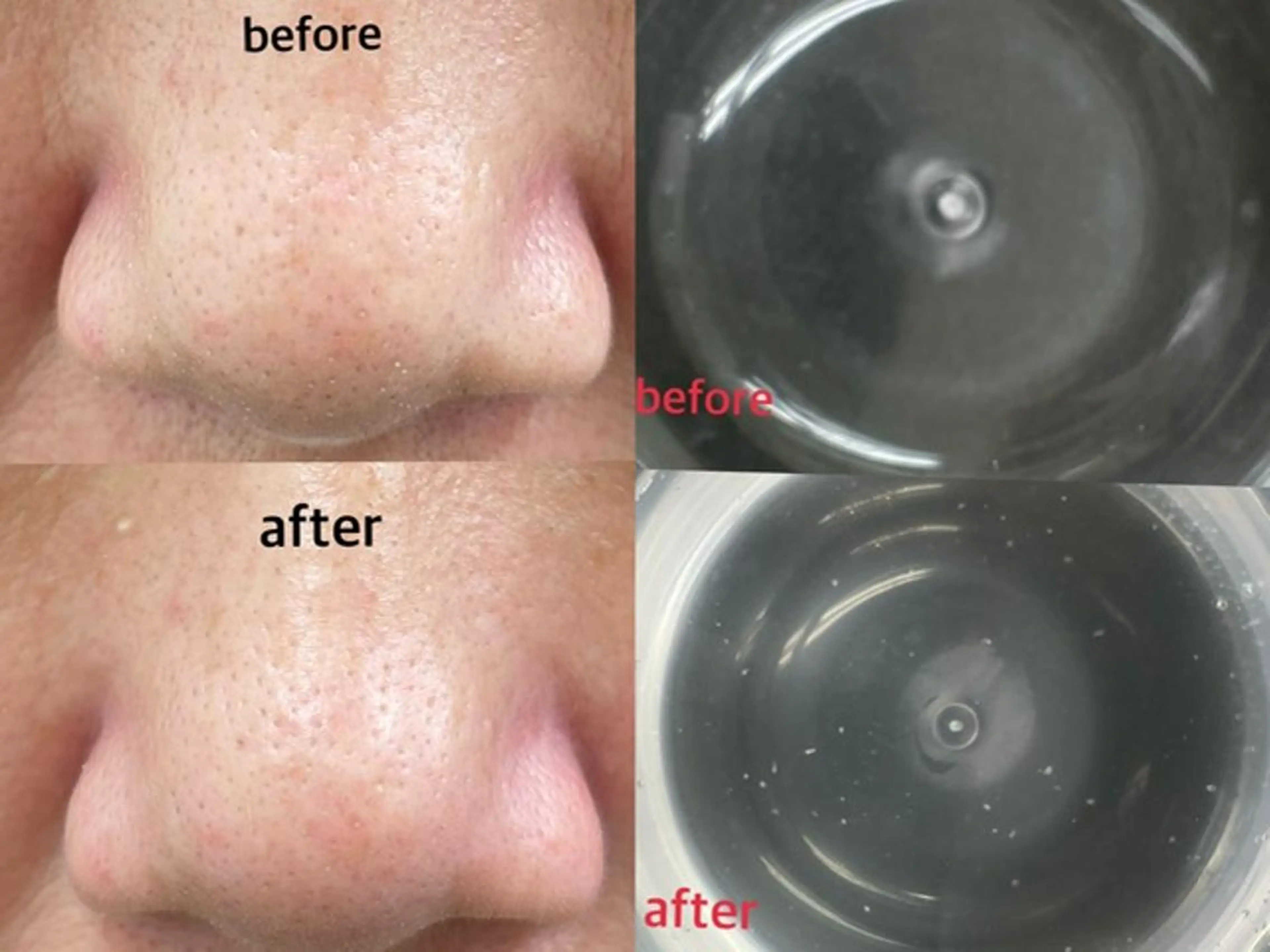 【鼻の毛穴洗浄×保湿】毛穴洗浄でイチゴ鼻払拭！1回￥2500/支払い現金の写真