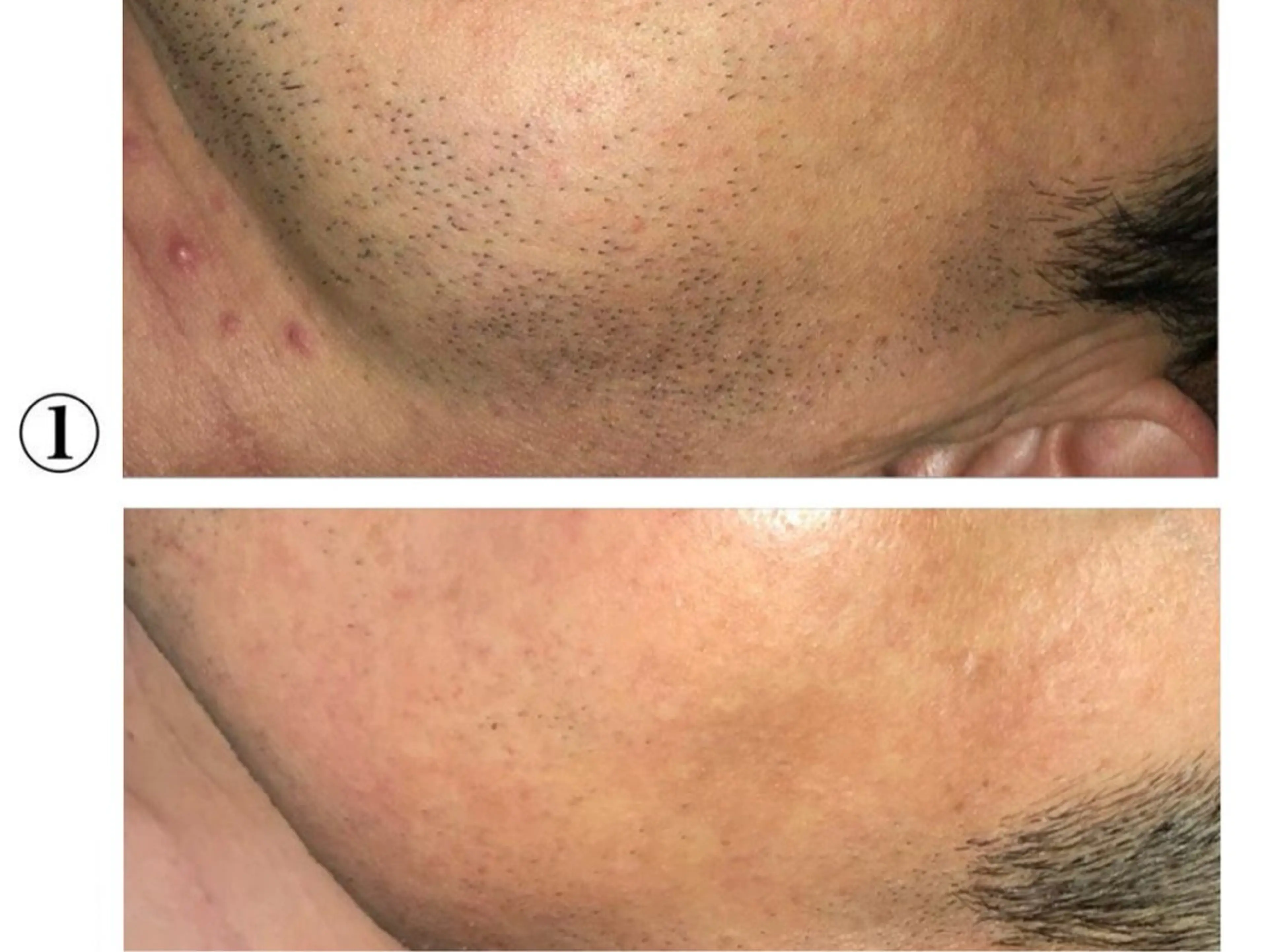 メンズ 脱毛 都度払い脱毛サロン　RE:JU17所属・エドワーズ 亜理沙のエステ・リラクイメージ