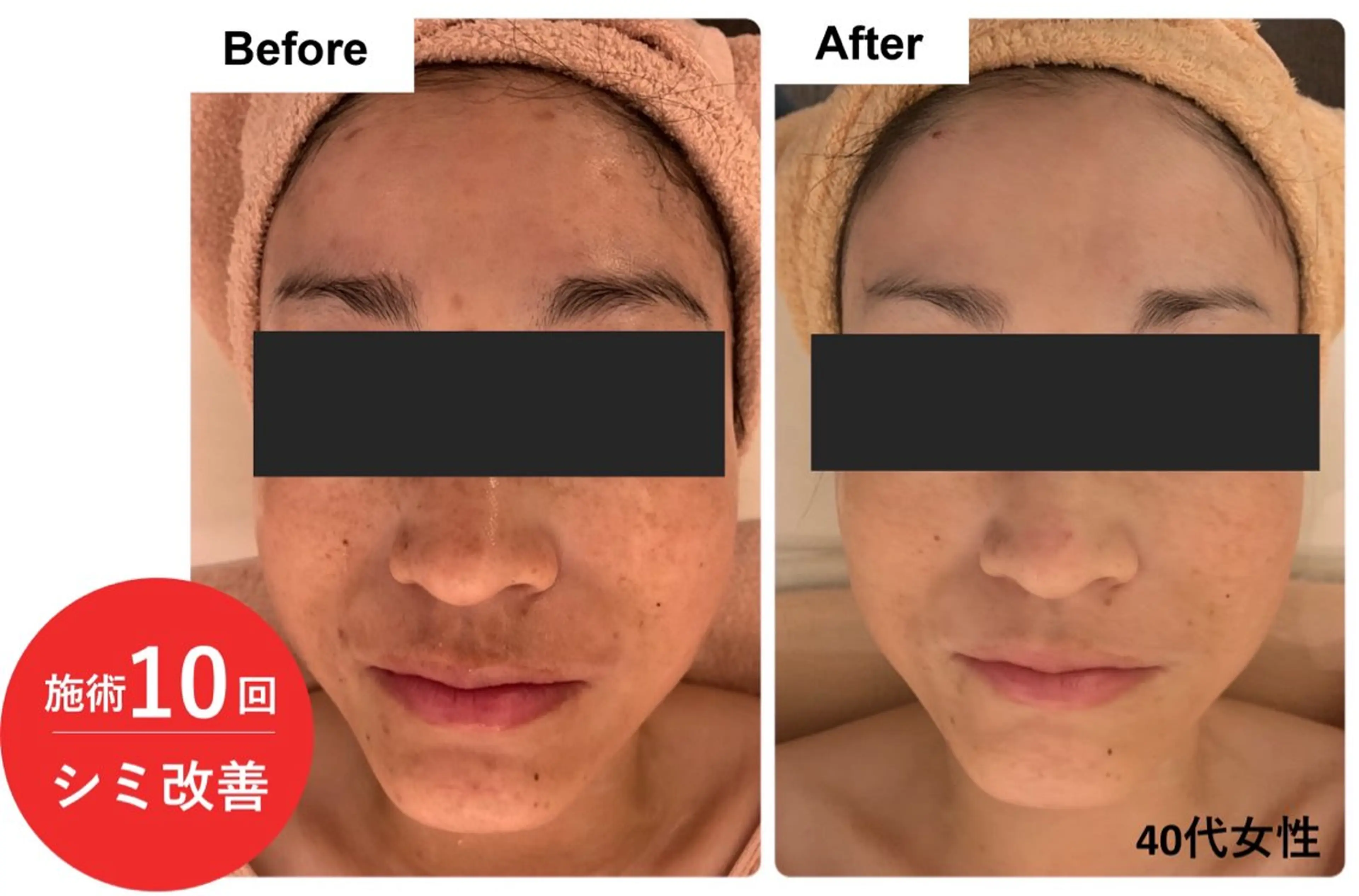 エステ シミ・若返り特化 さゆみのエステ・リラクイメージ