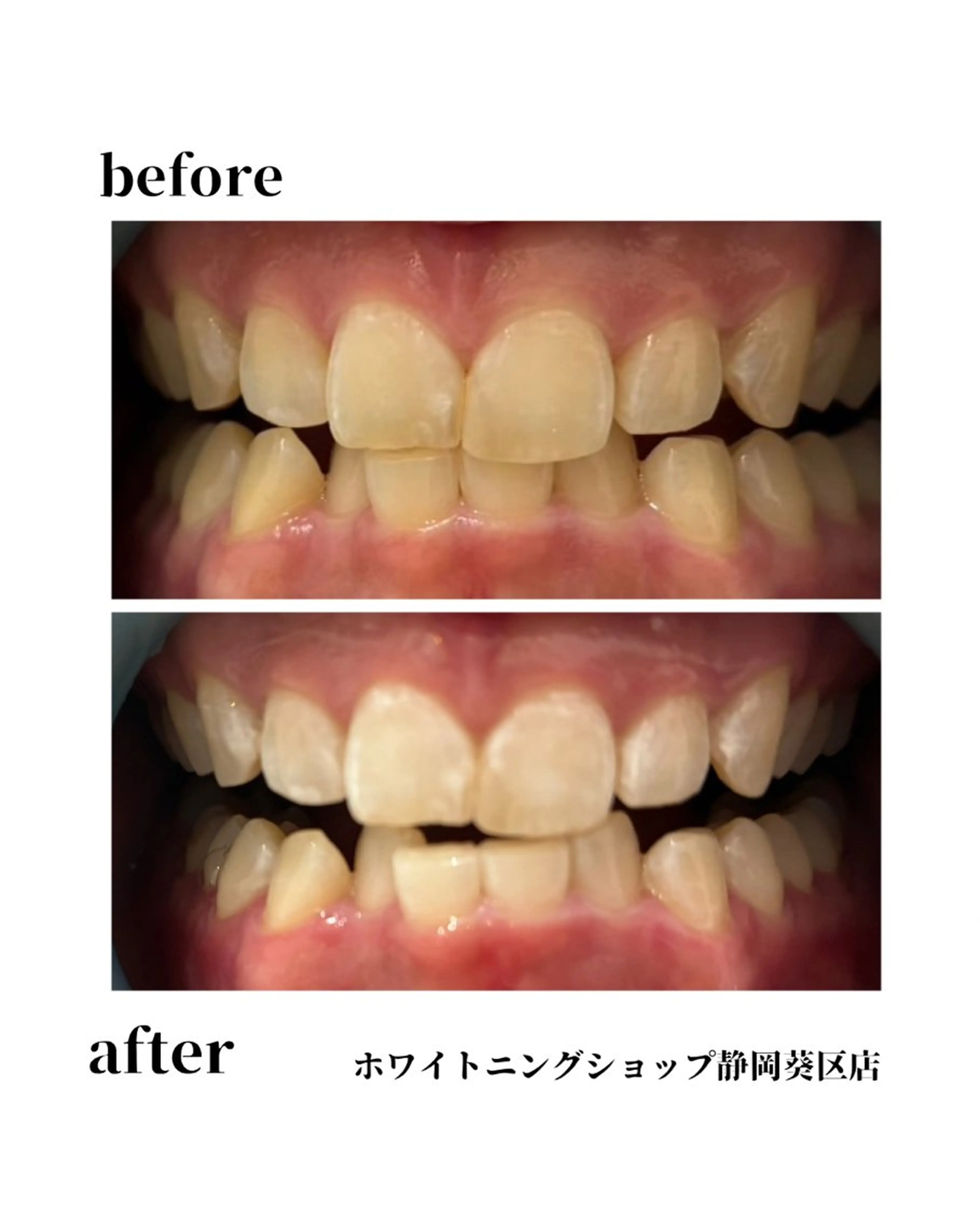 その他 ホワイトニングショップ静岡葵区店所属・ホワイトニング ショップ葵区静岡駅店のその他イメージ