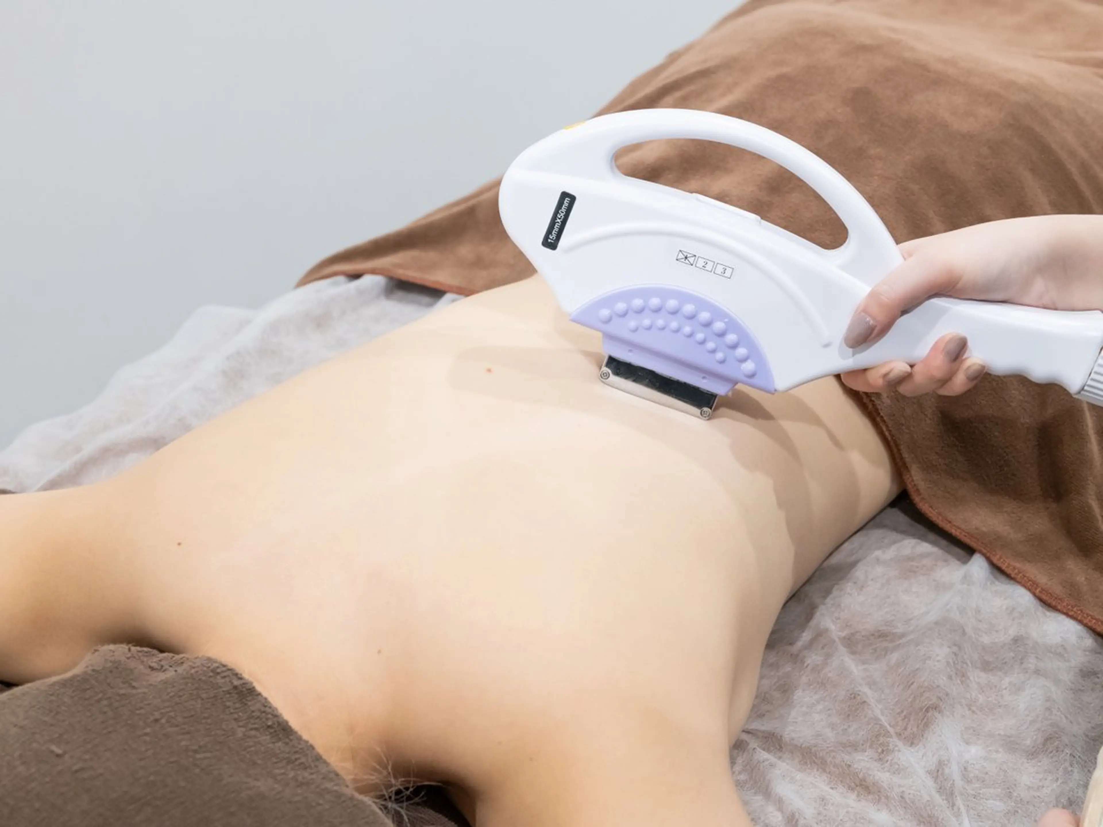 【女性】360°全身脱毛（顔･VIO込み） 🤍の写真