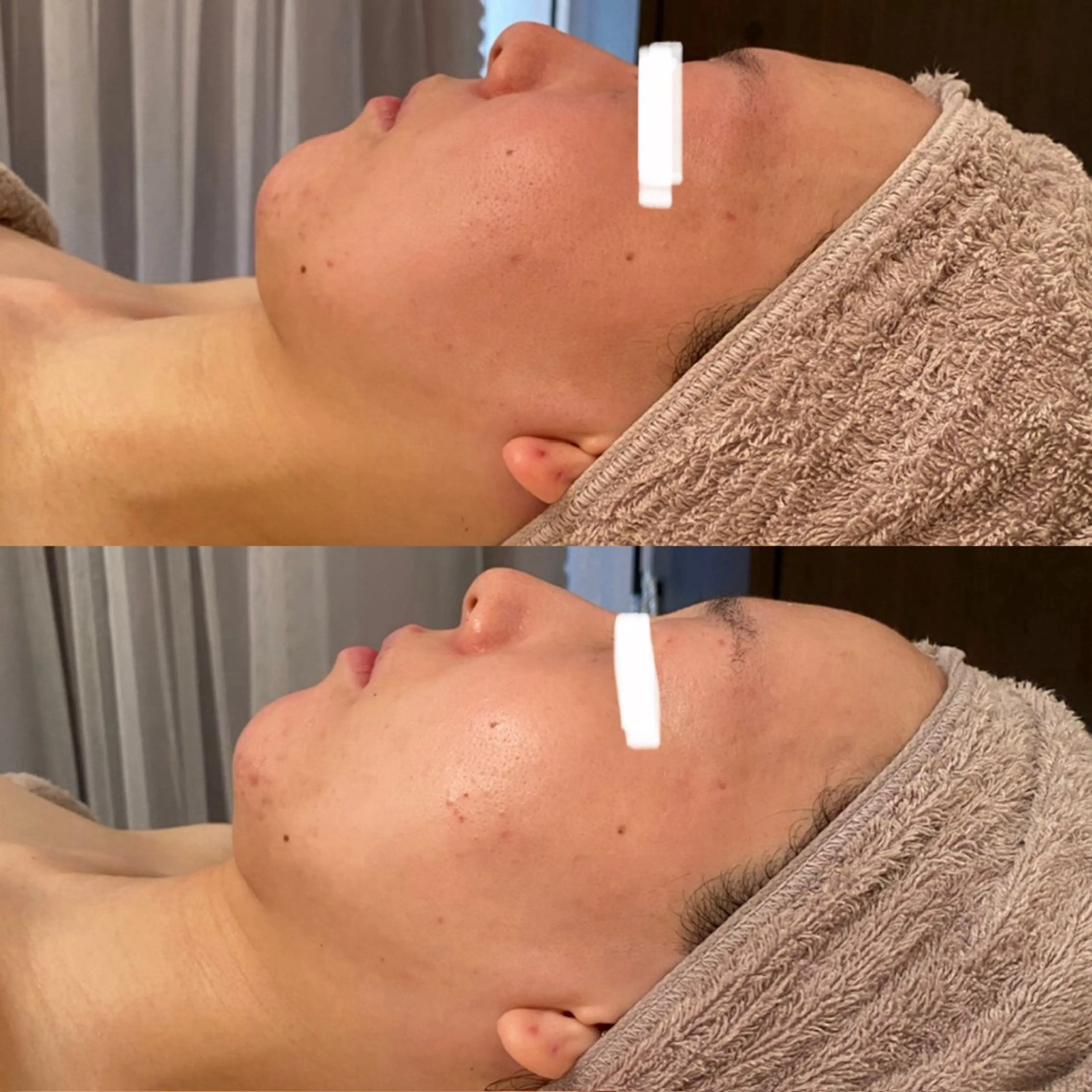 田中For..天王寺 肌質改善/よもぎ蒸しのエステ・リラクイメージ