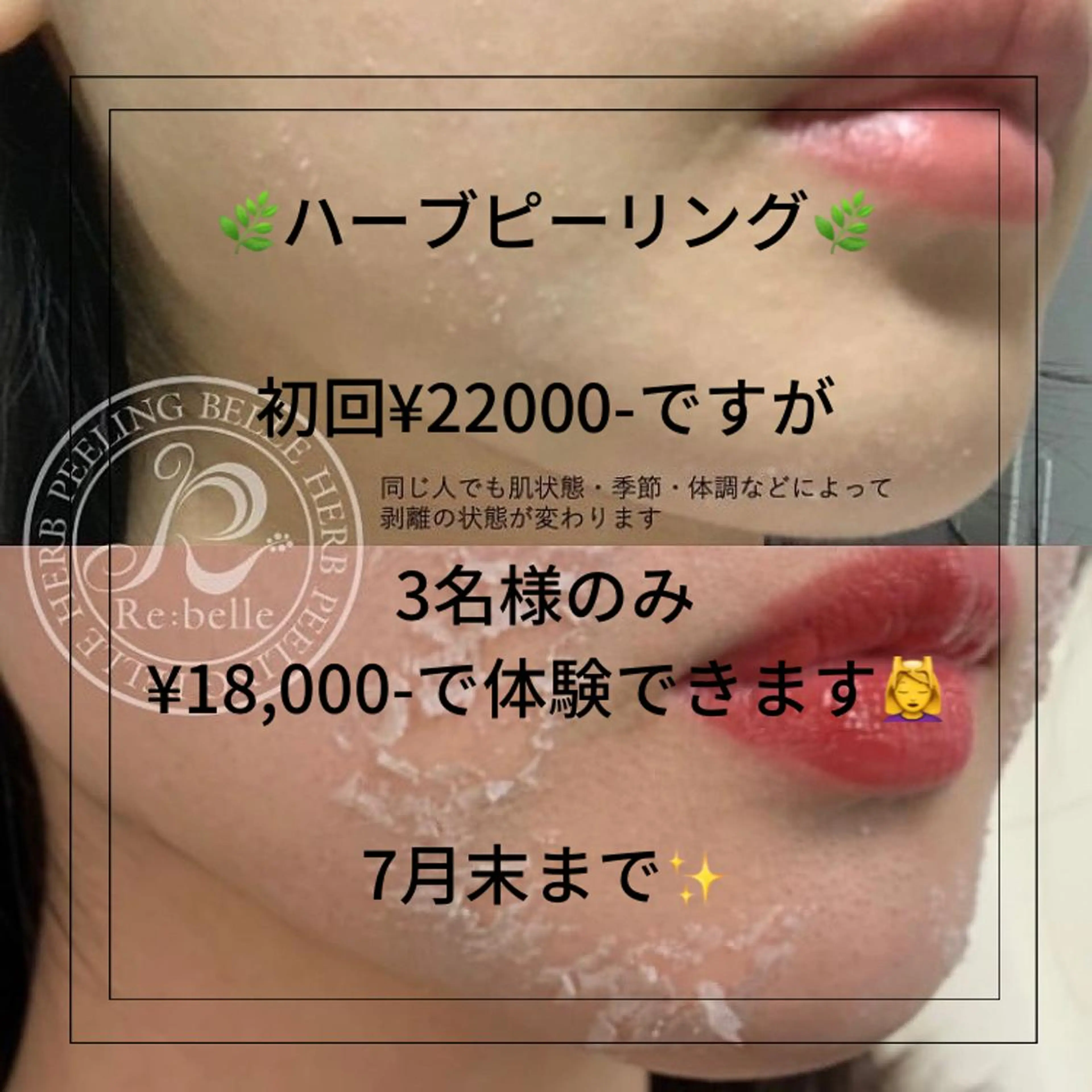 アイブロウ エステ Amm所属・🏆艶肌ワックス🏆 ララピール✨Ammのエステ・リラクイメージ