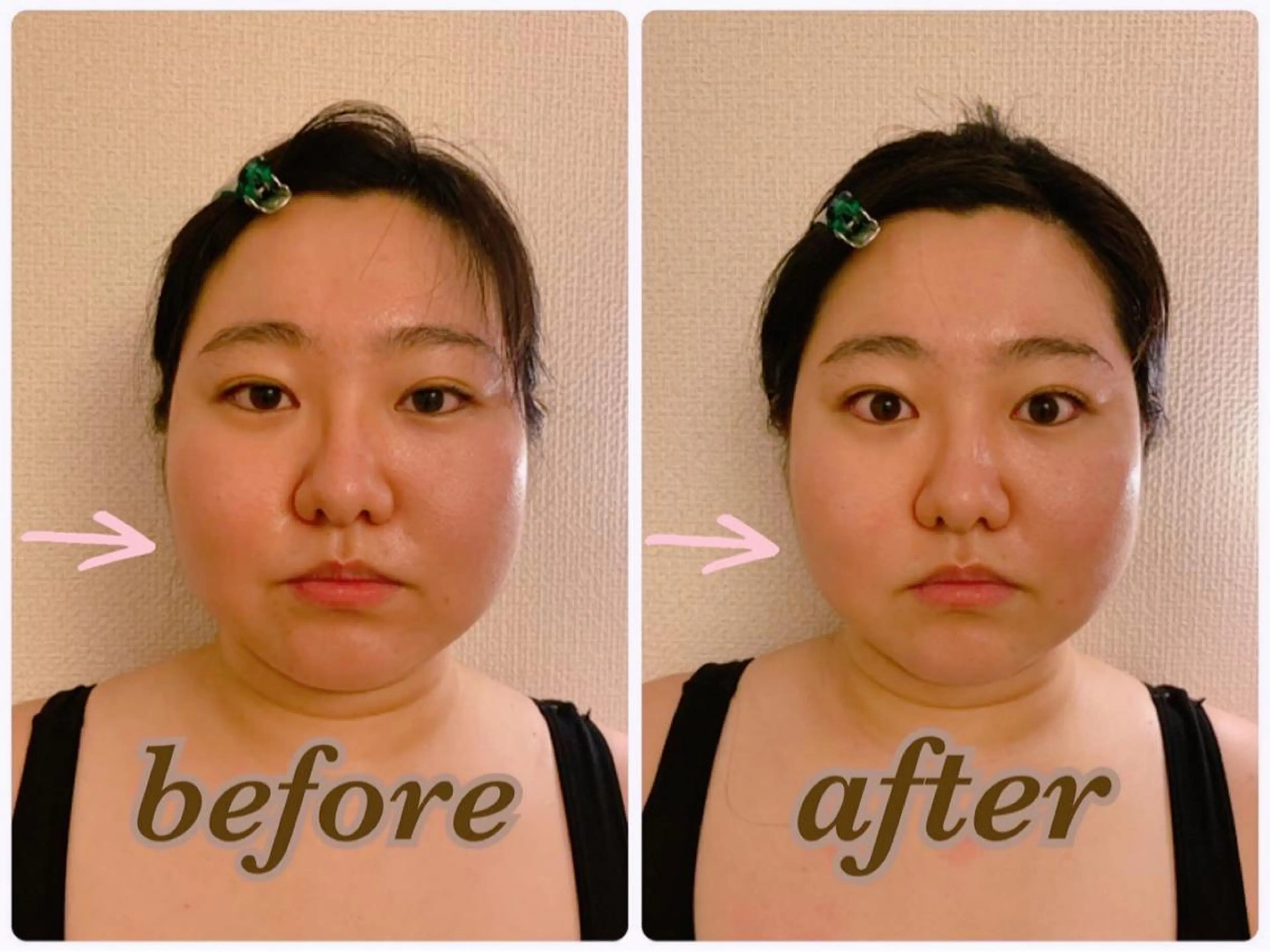 【背中から引き上げ⤴️】💎造顔リフトアップコース70分💎の写真