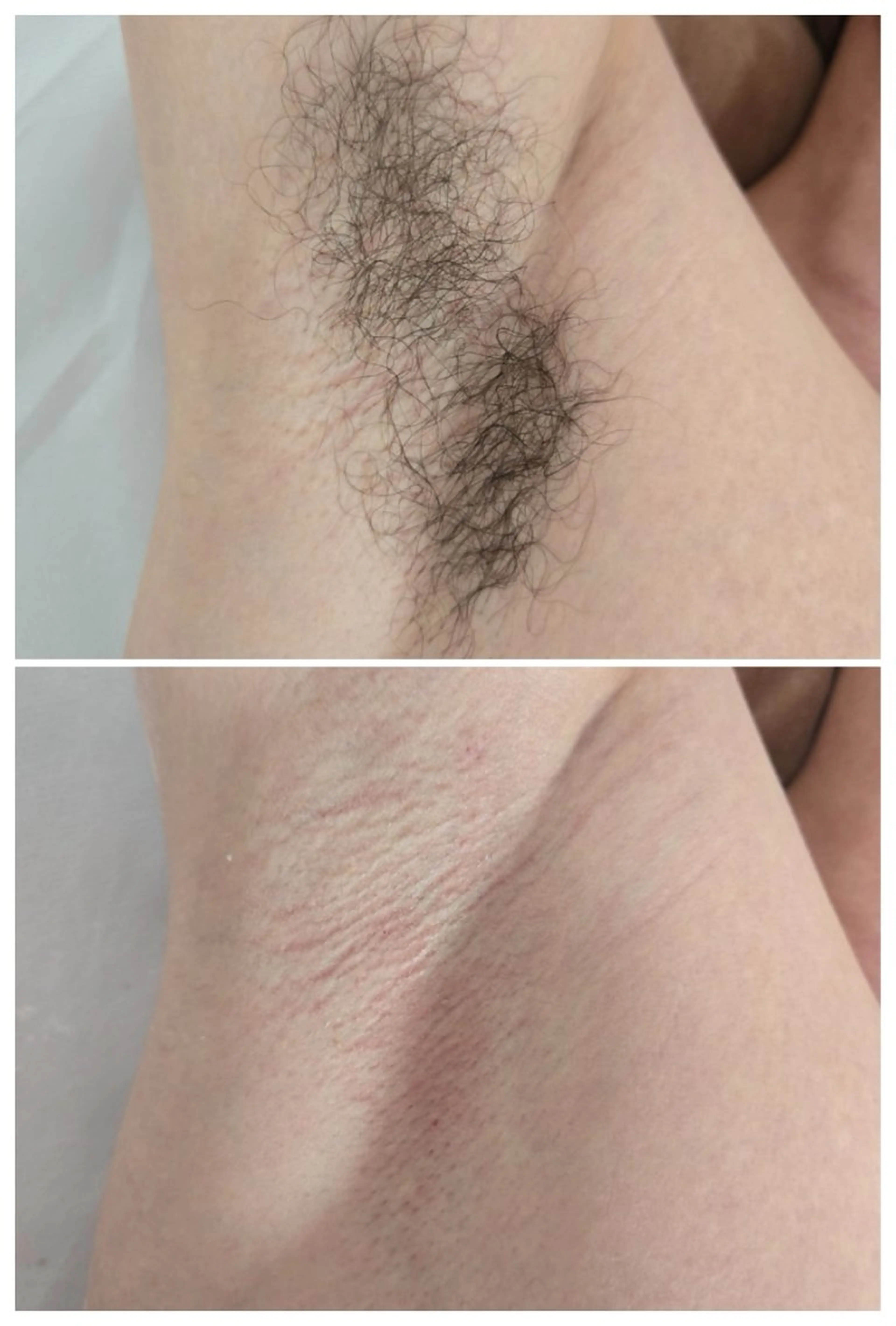 脱毛 TAKAMATSU RINAのネイルデザイン