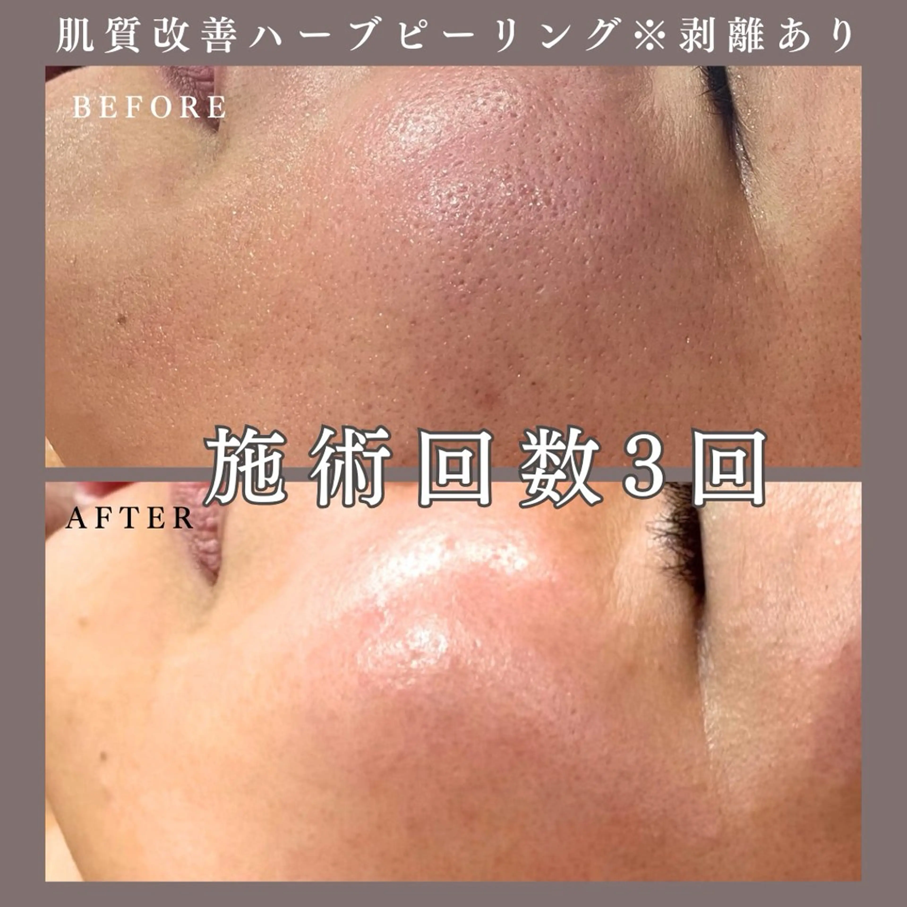 エステ 肌質改善専門サロン Bellmi/心斎橋のエステ・リラクイメージ