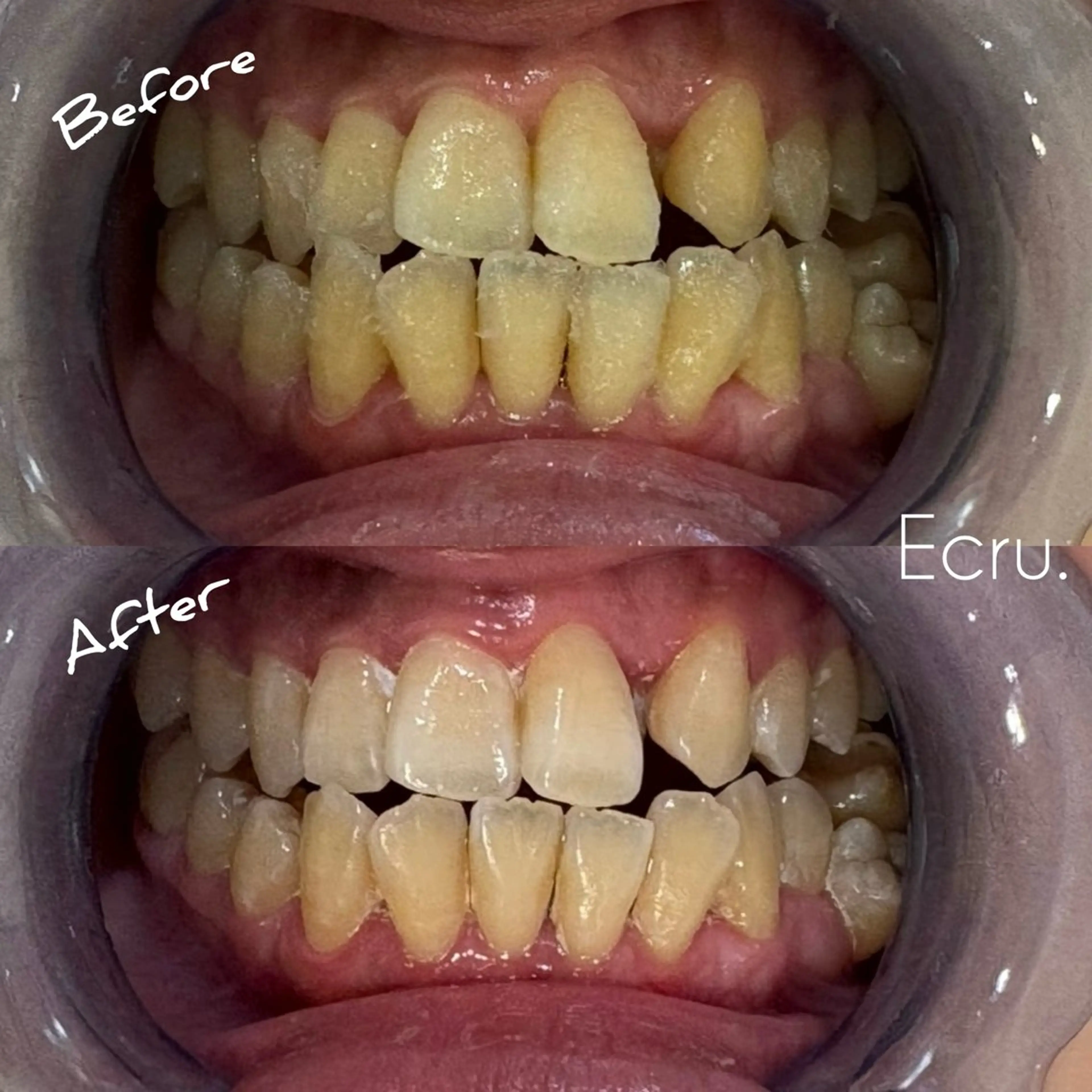 メンズ キッズ エステ ホワイトニングサロン Ecru所属・ホワイトニングサロン Ecru エクリュのその他イメージ