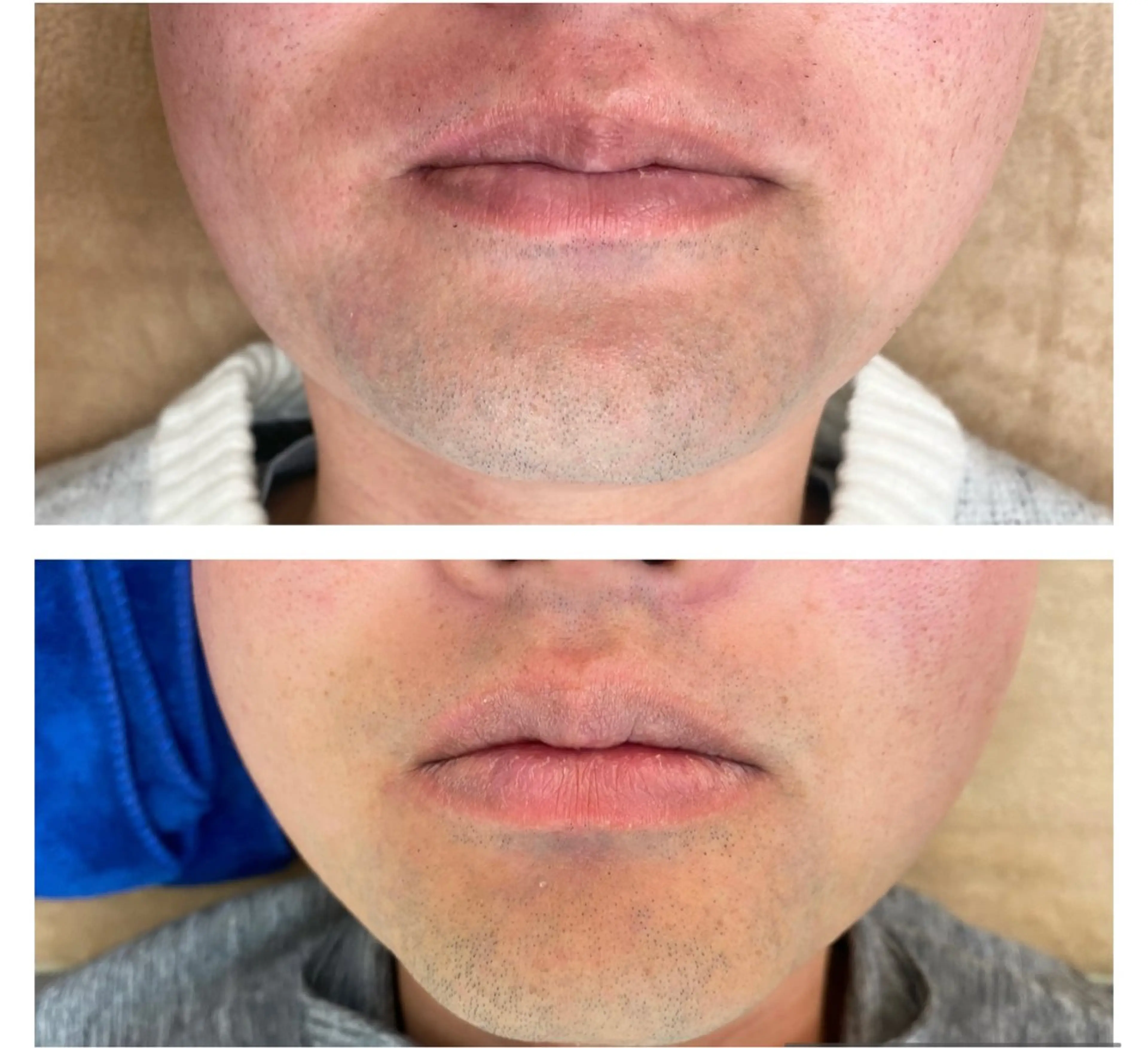 メンズ 脱毛 RE:moom リムーム/脱毛エステのエステ・リラクイメージ