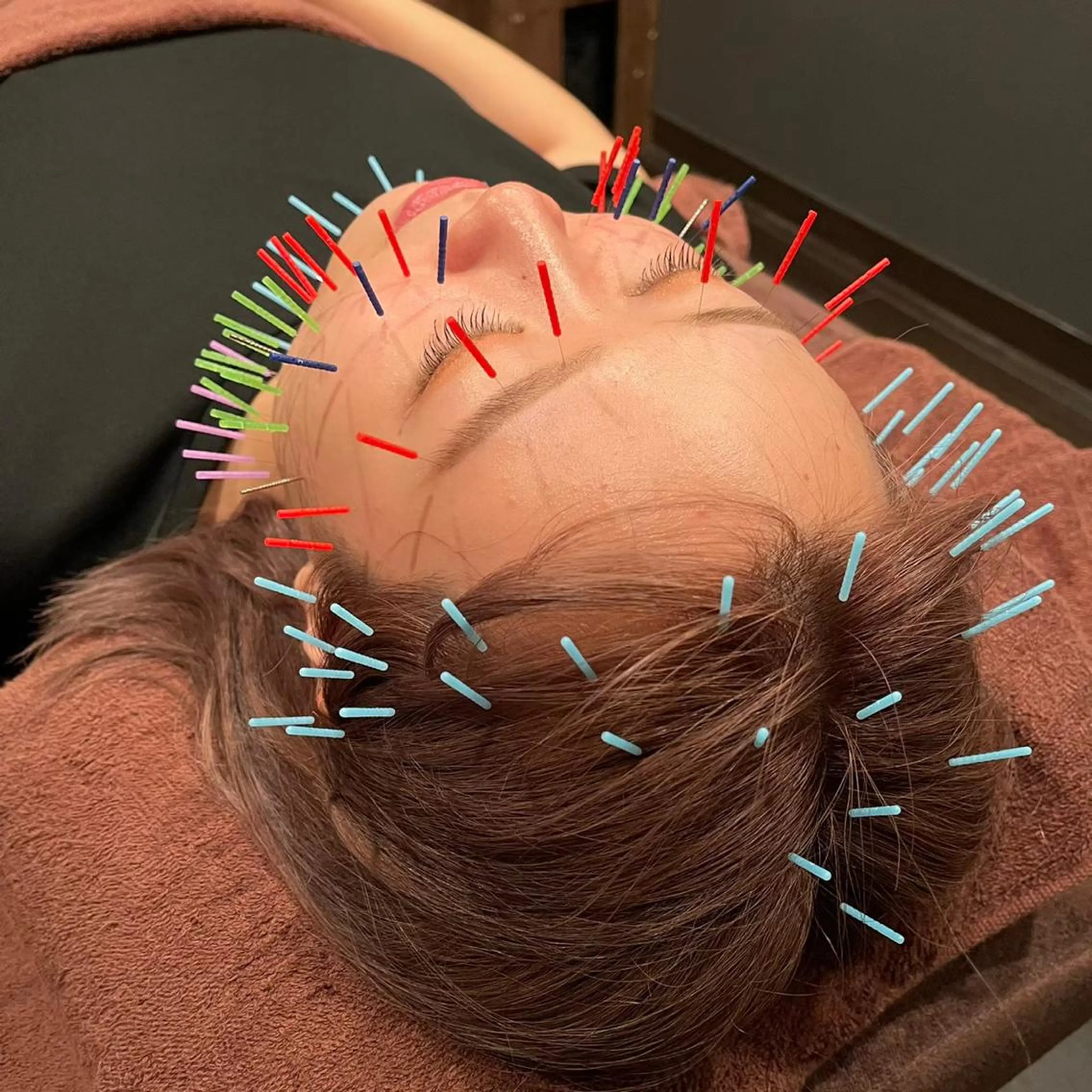 小林整骨院玉川 キジマのエステ・リラクイメージ