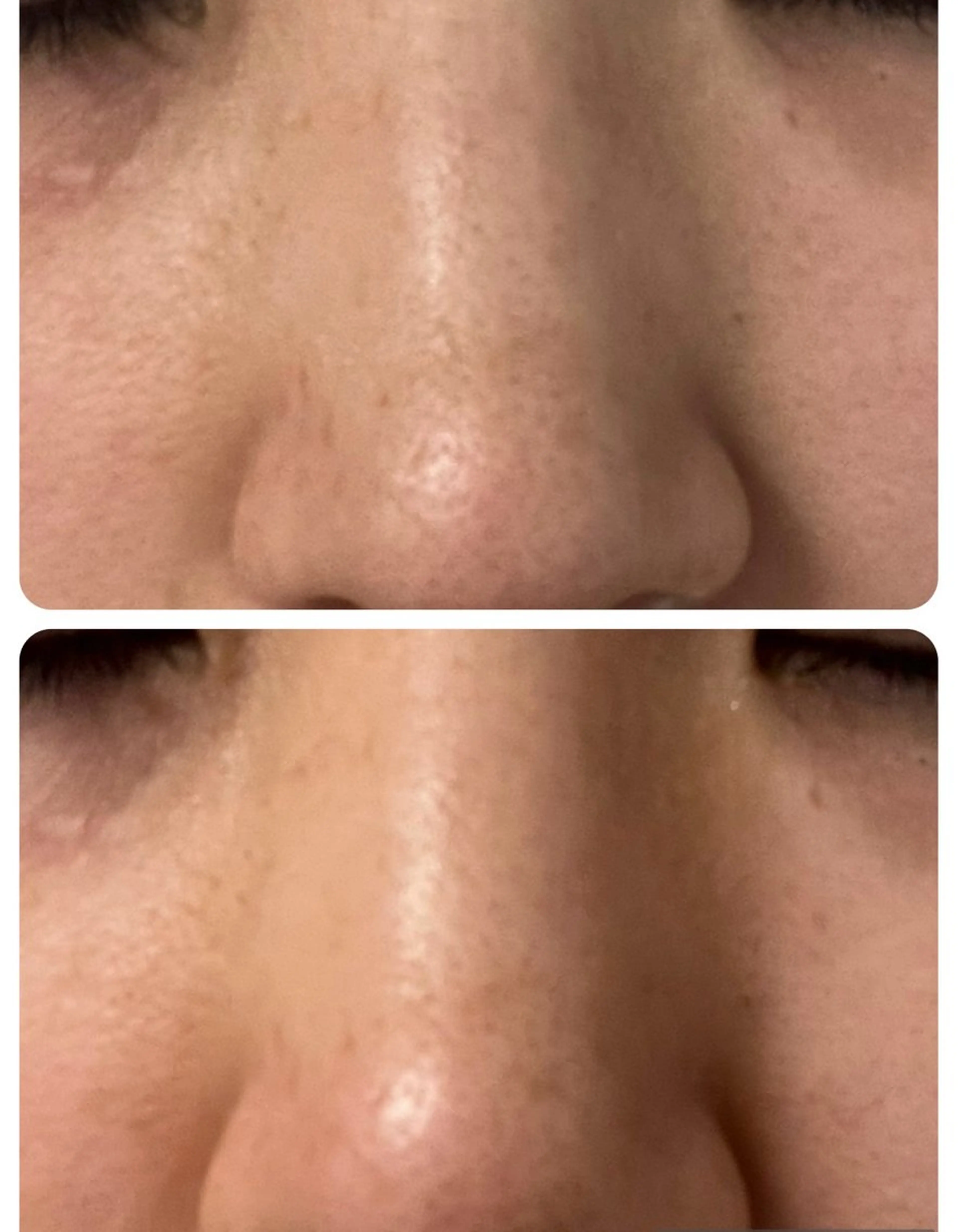 エステ リラク 愛維美水光美肌専門店所属・愛維美水光美肌専門店 メンズレディースokのエステ・リラクイメージ