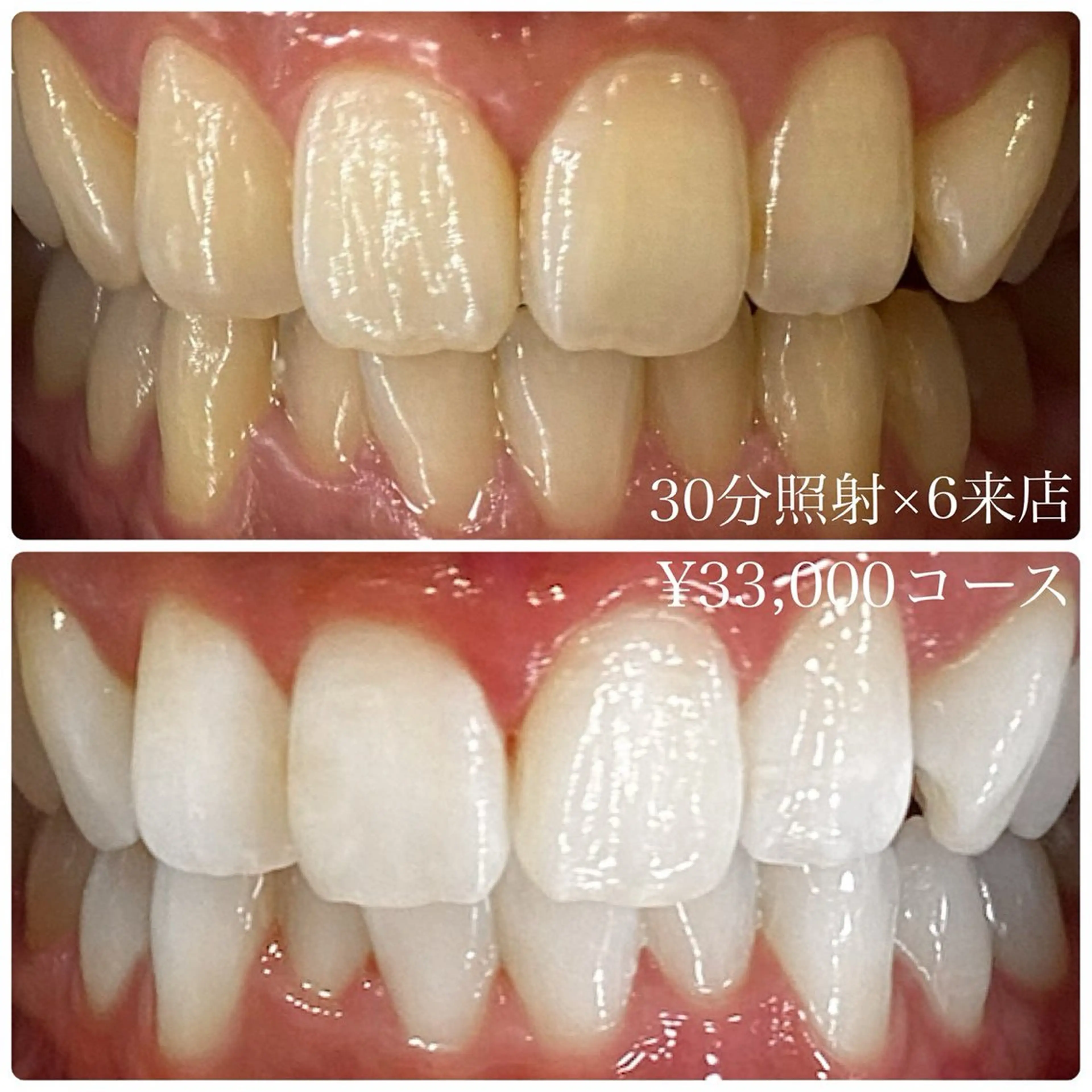 PLATINUM Beauty 横浜店所属・ホワイトニングルーム 横浜店のその他イメージ