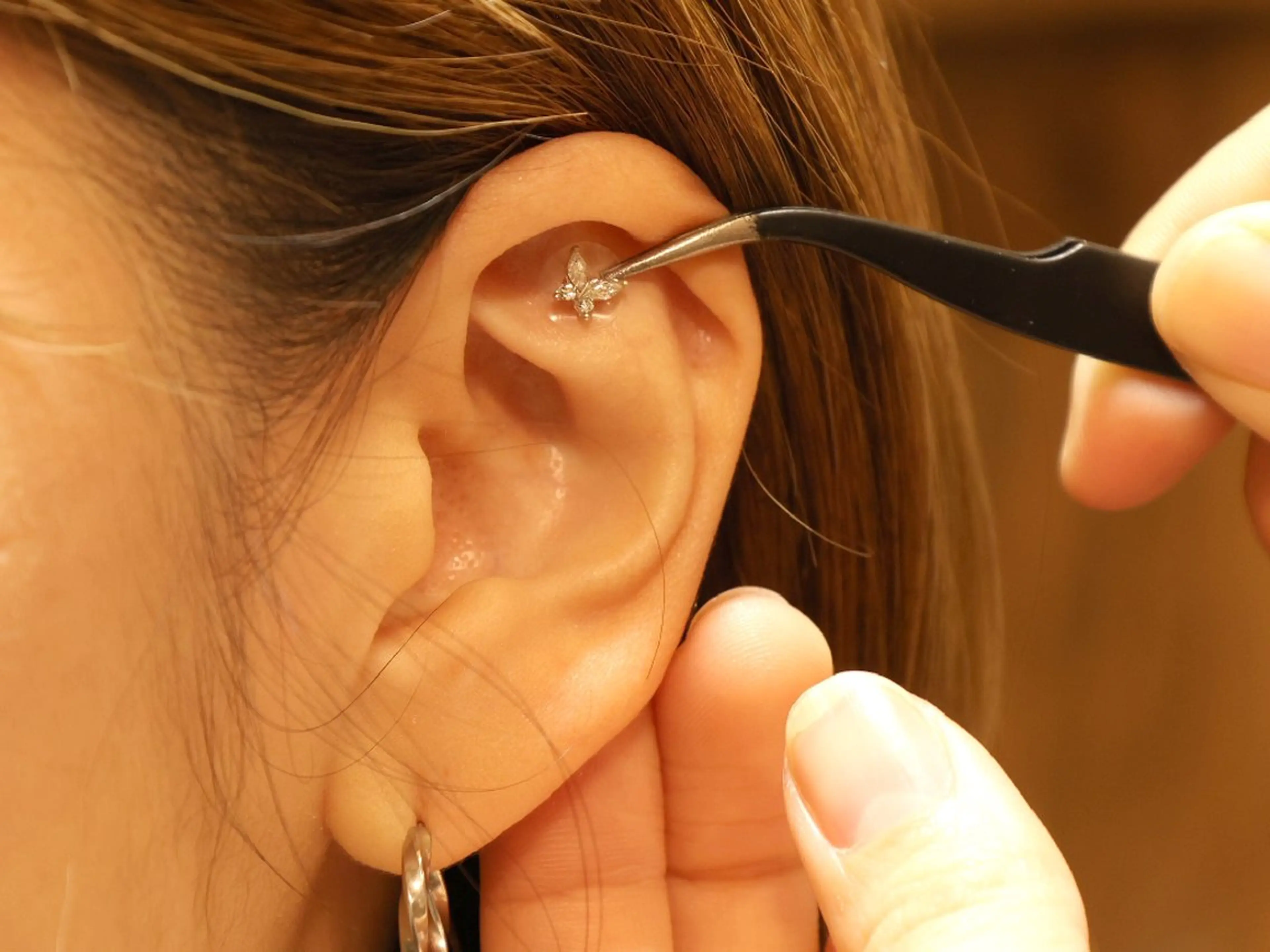 その他 トータルビューティーサロン宿り木所属・江坂@宿り木　脱毛+ 耳ツボ+よもぎ蒸しのエステ・リラクイメージ