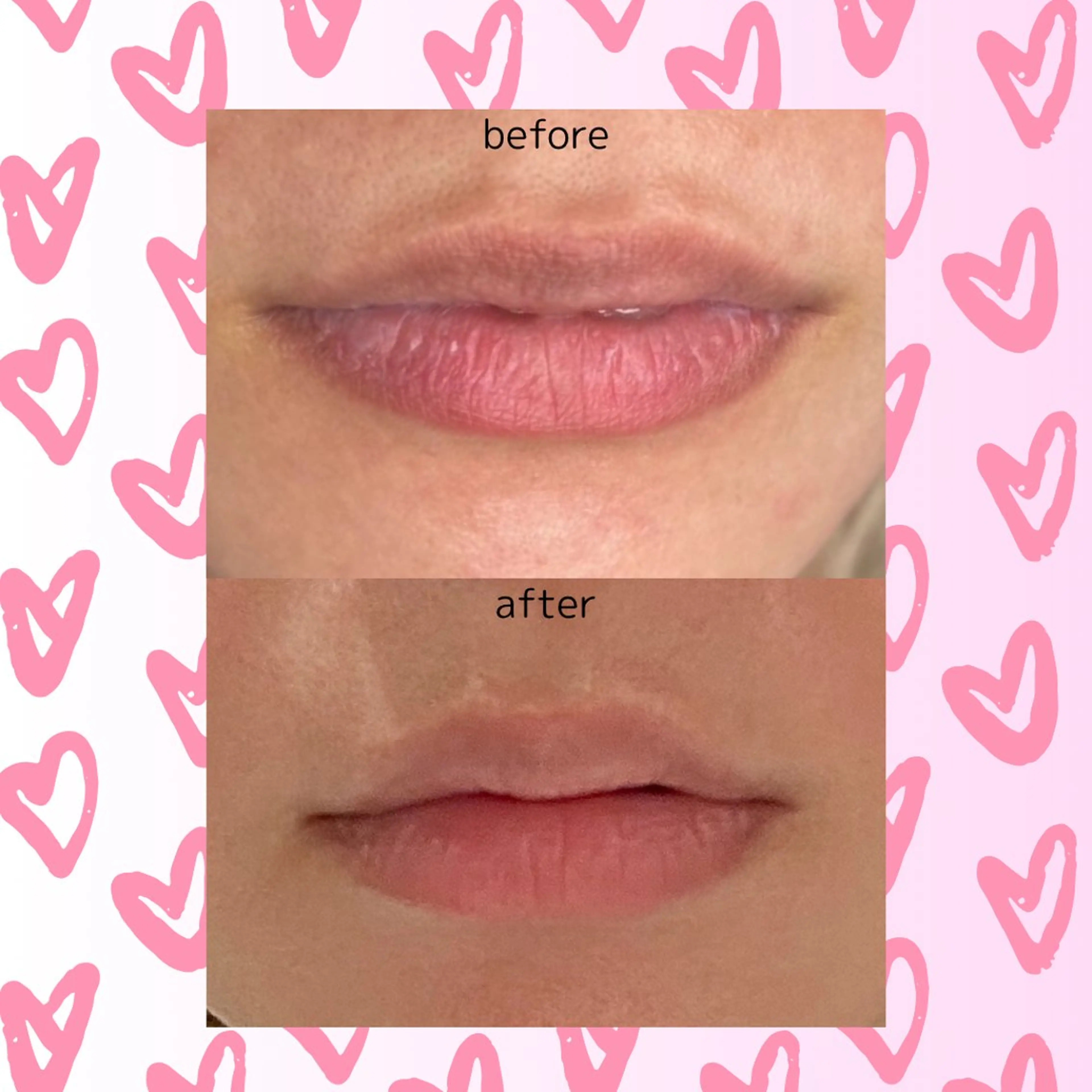 歌舞伎町深夜サロン to mëのエステ・リラクイメージ