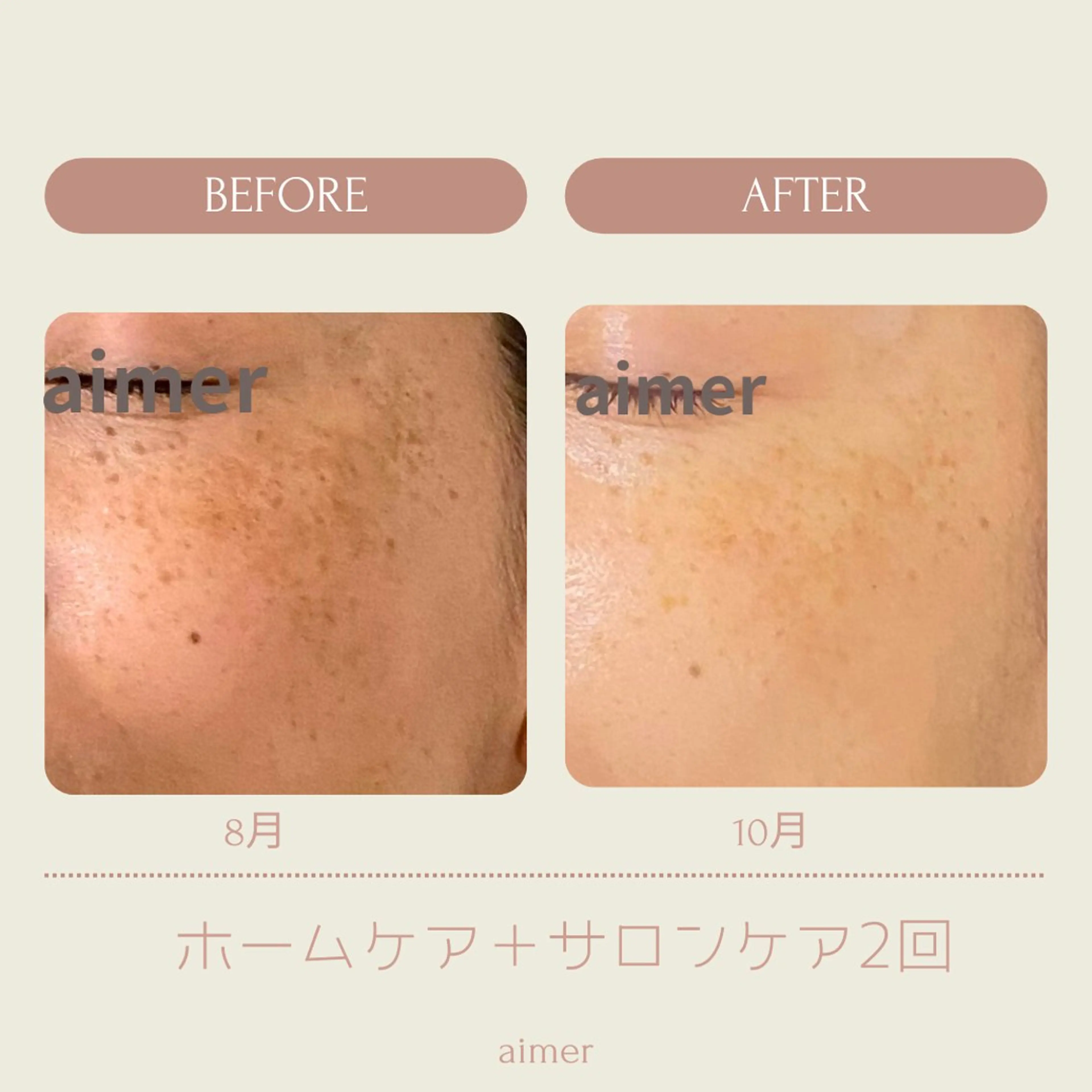 エステ aimer beautyのエステ・リラクイメージ