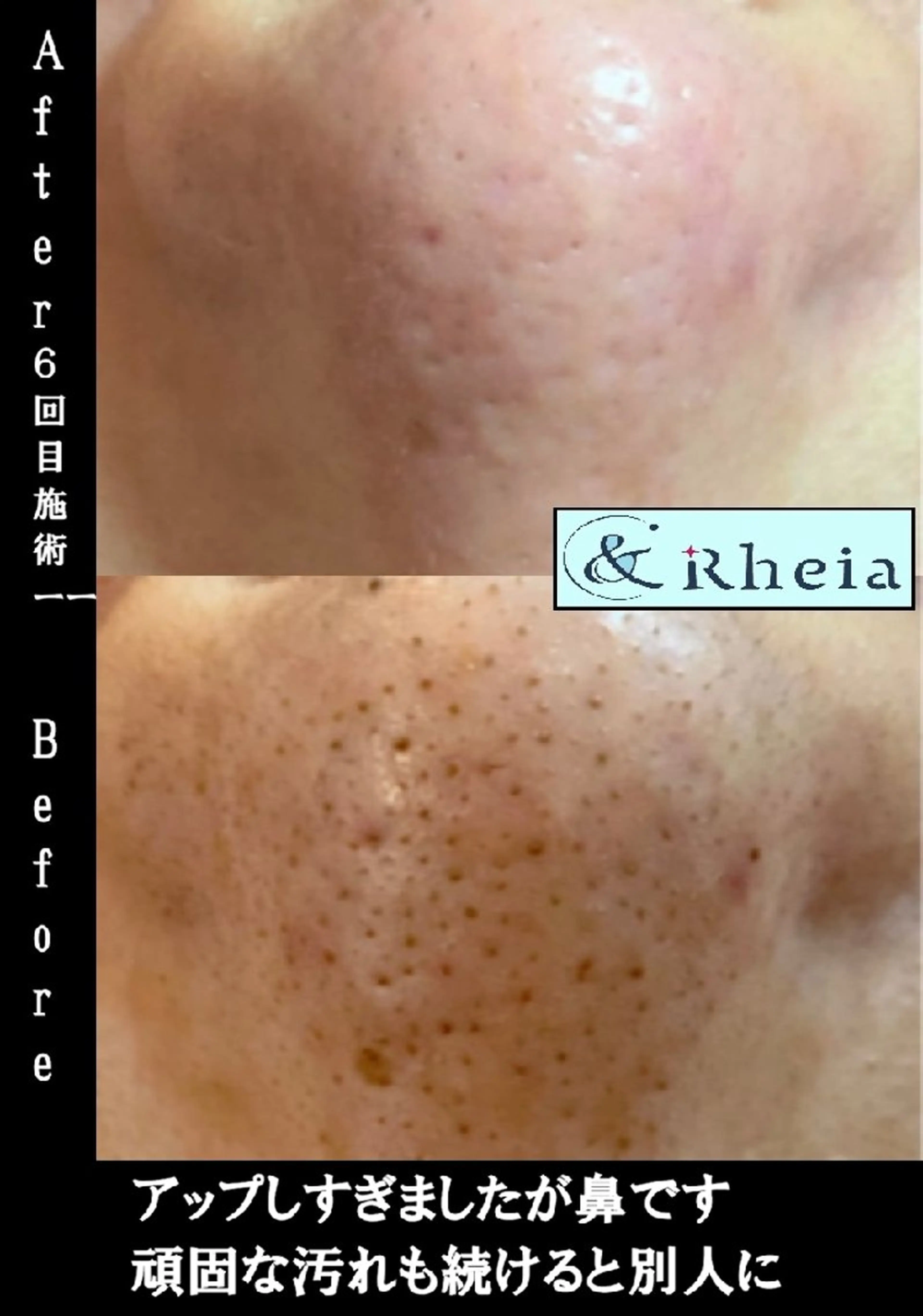 メンズ エステ &Rheia(アンドレイア)所属・kawashima mariの眉毛・アイブロウイメージ