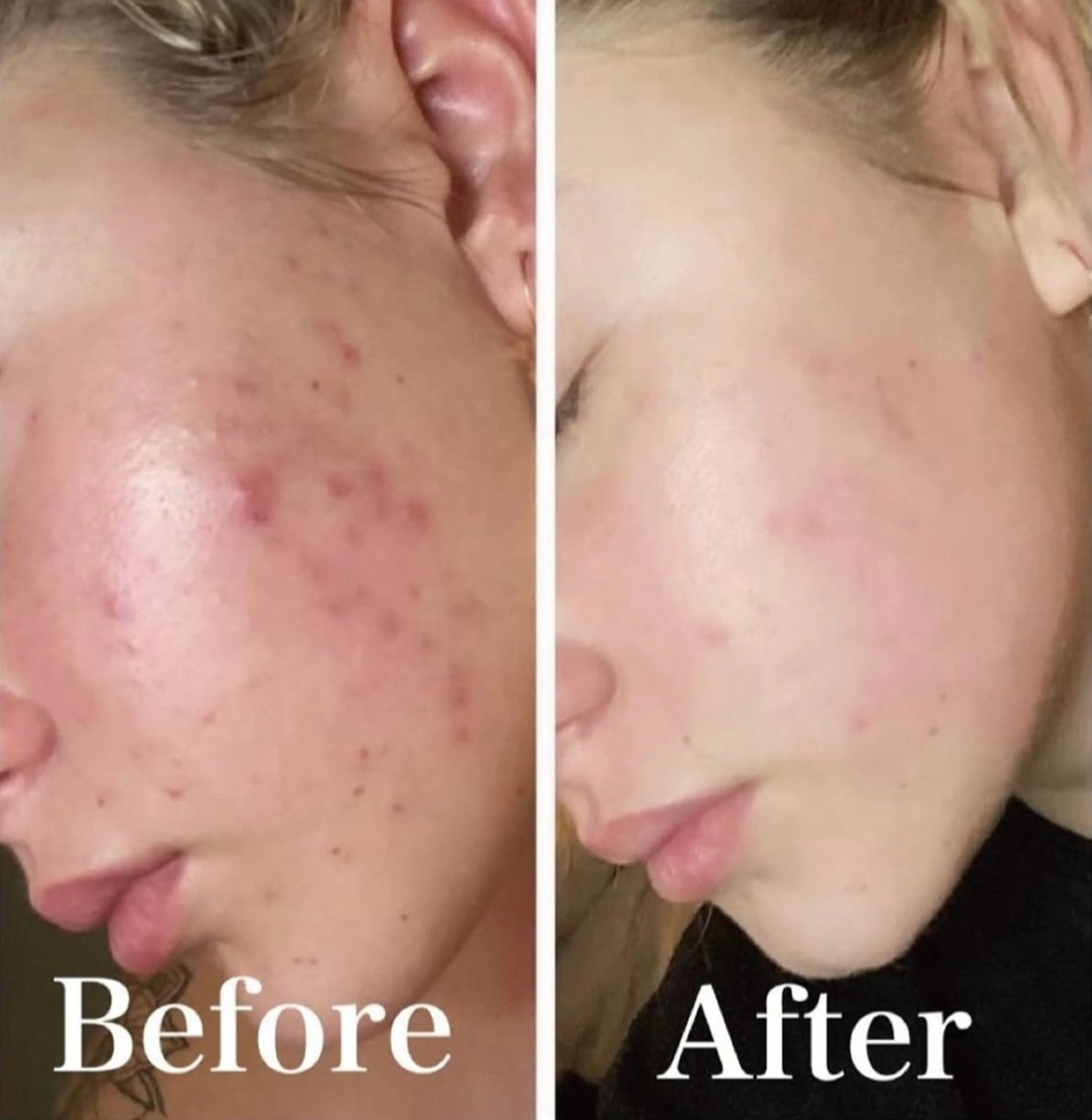 Blooming所属・LOUISE. ／肌質・頭皮のエステ・リラクイメージ