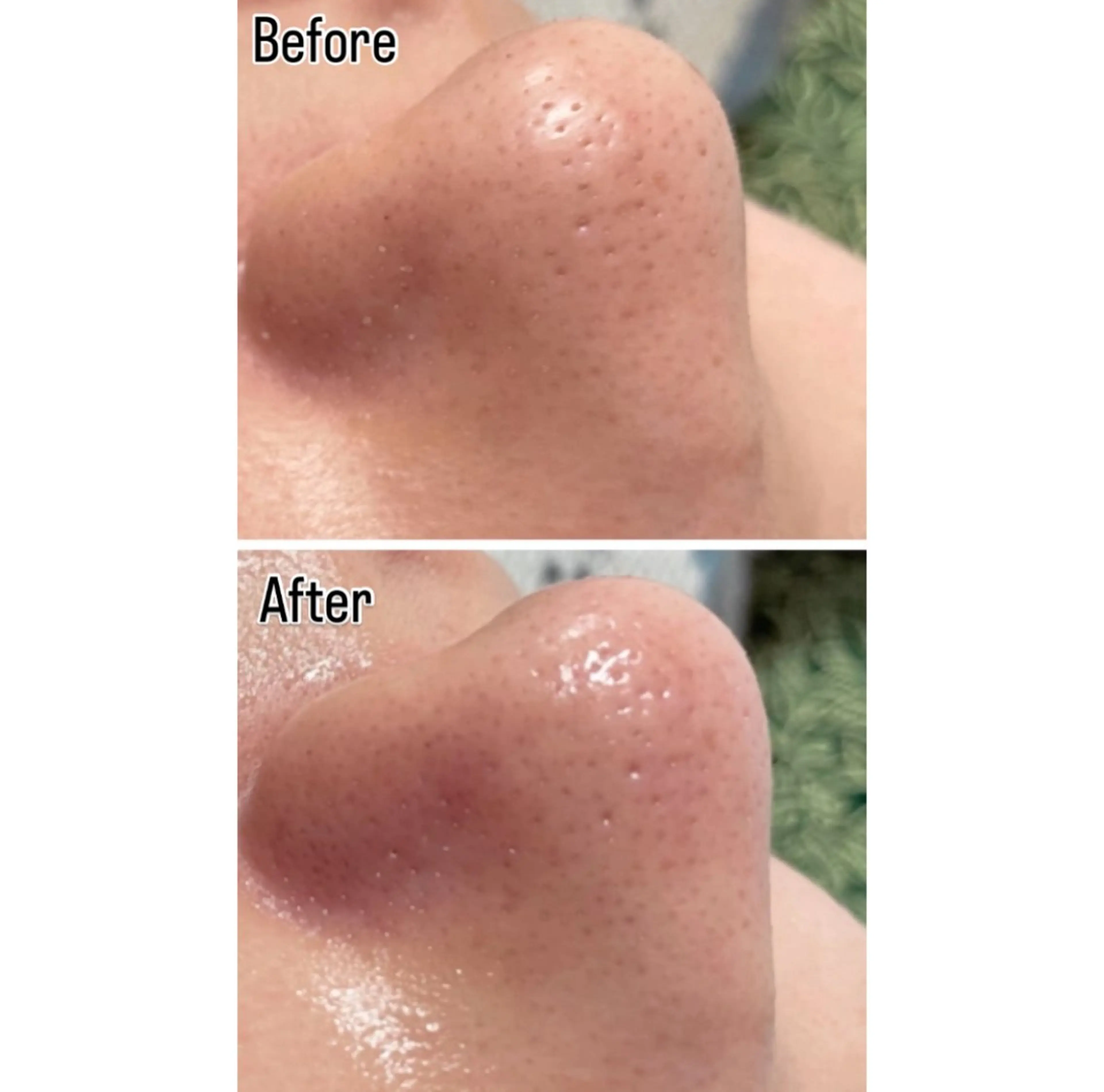 DISINI  SPA所属・DISINISPA 脱毛/フェイシャルのエステ・リラクイメージ