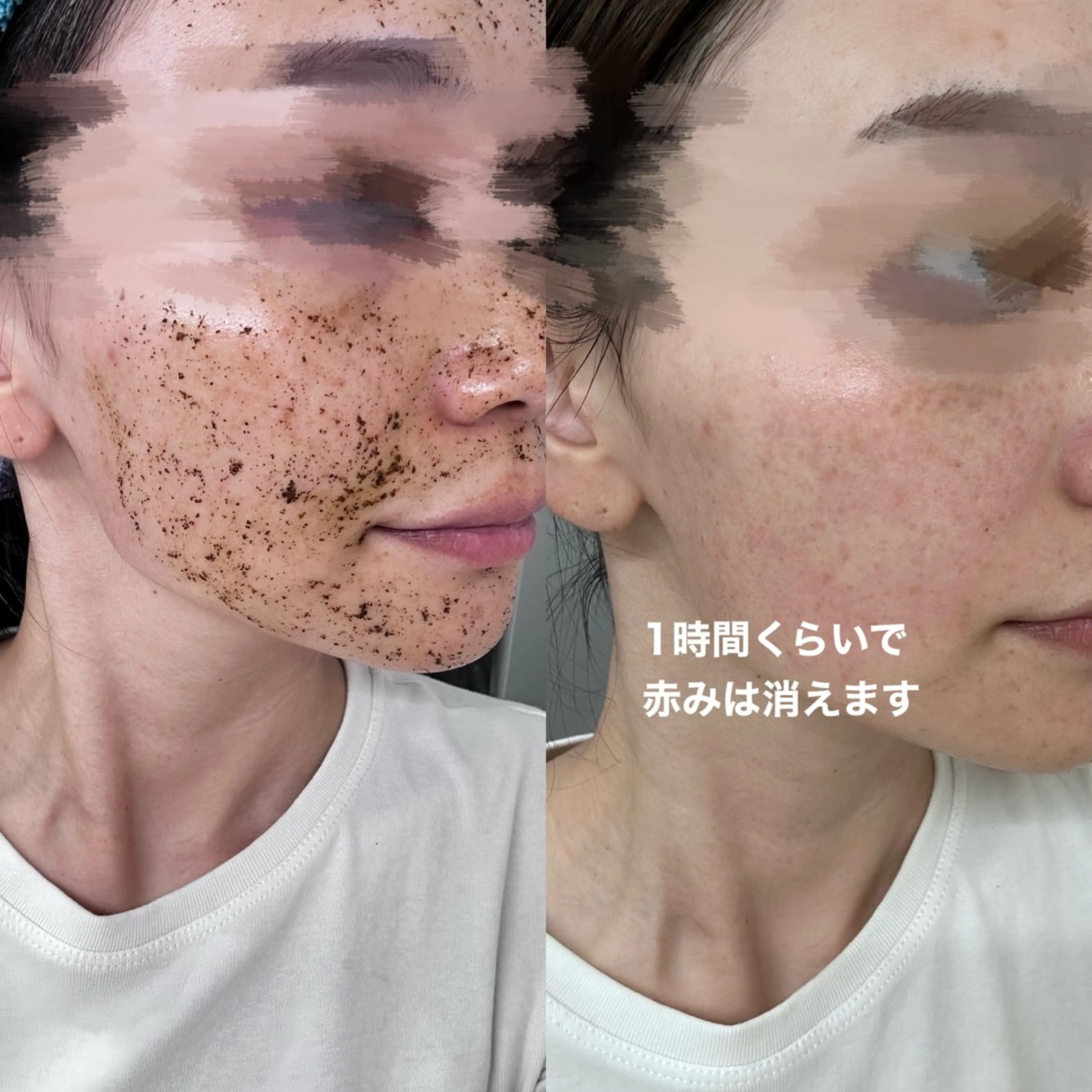 salon moi(モア)のエステ・リラクイメージ