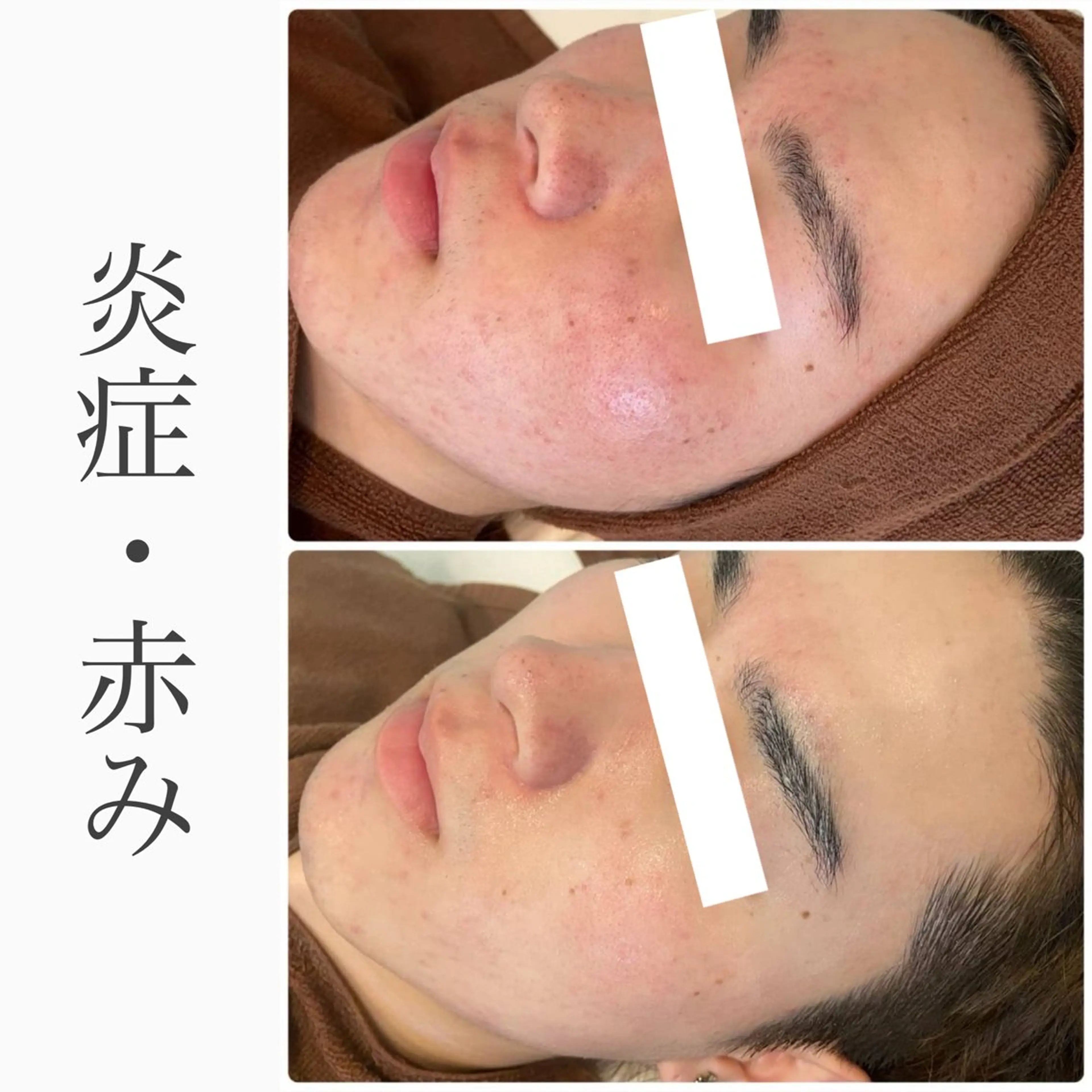 ハーブピーリング専門 BIOEL横浜のエステ・リラクイメージ