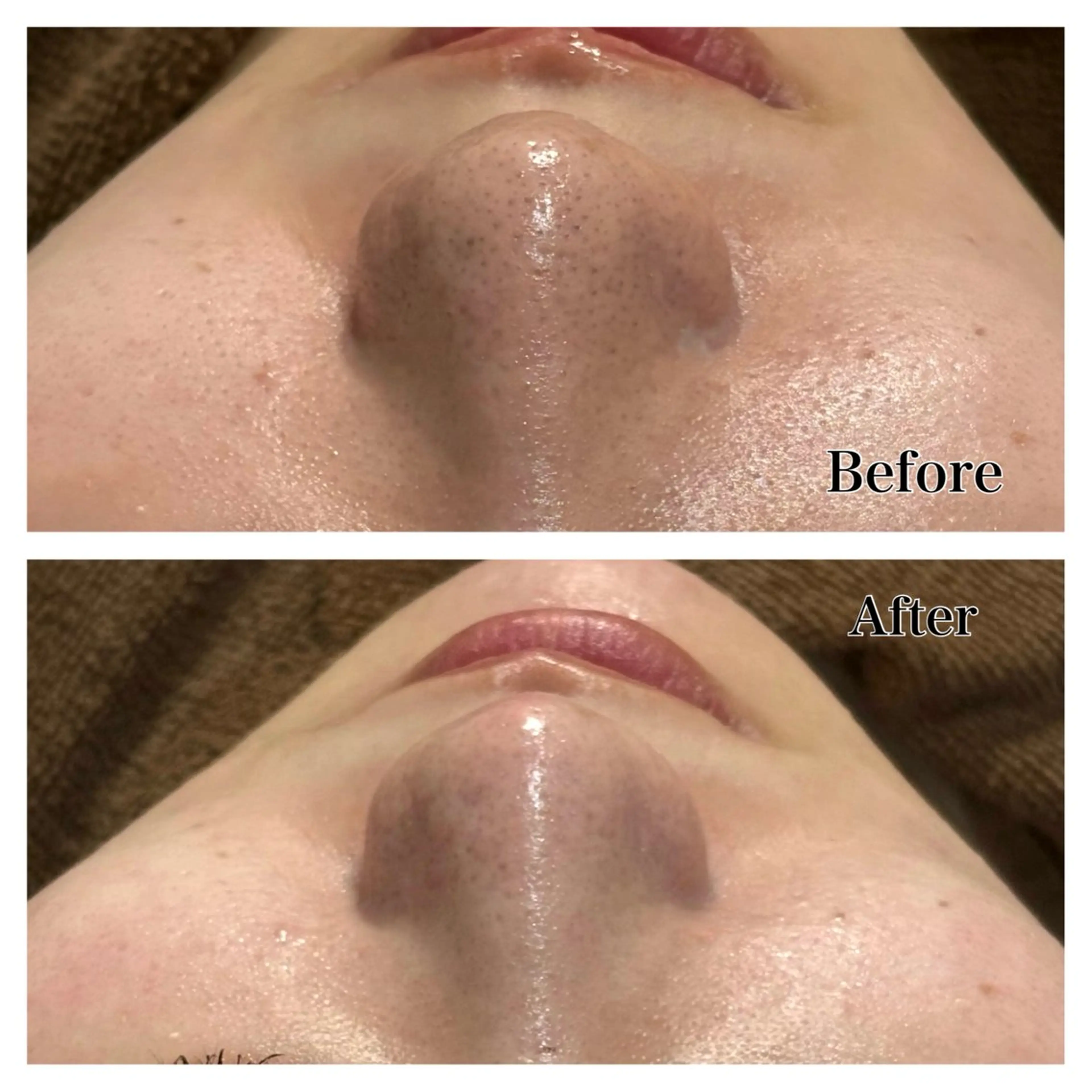 エステ kamie suzuneの眉毛・アイブロウイメージ