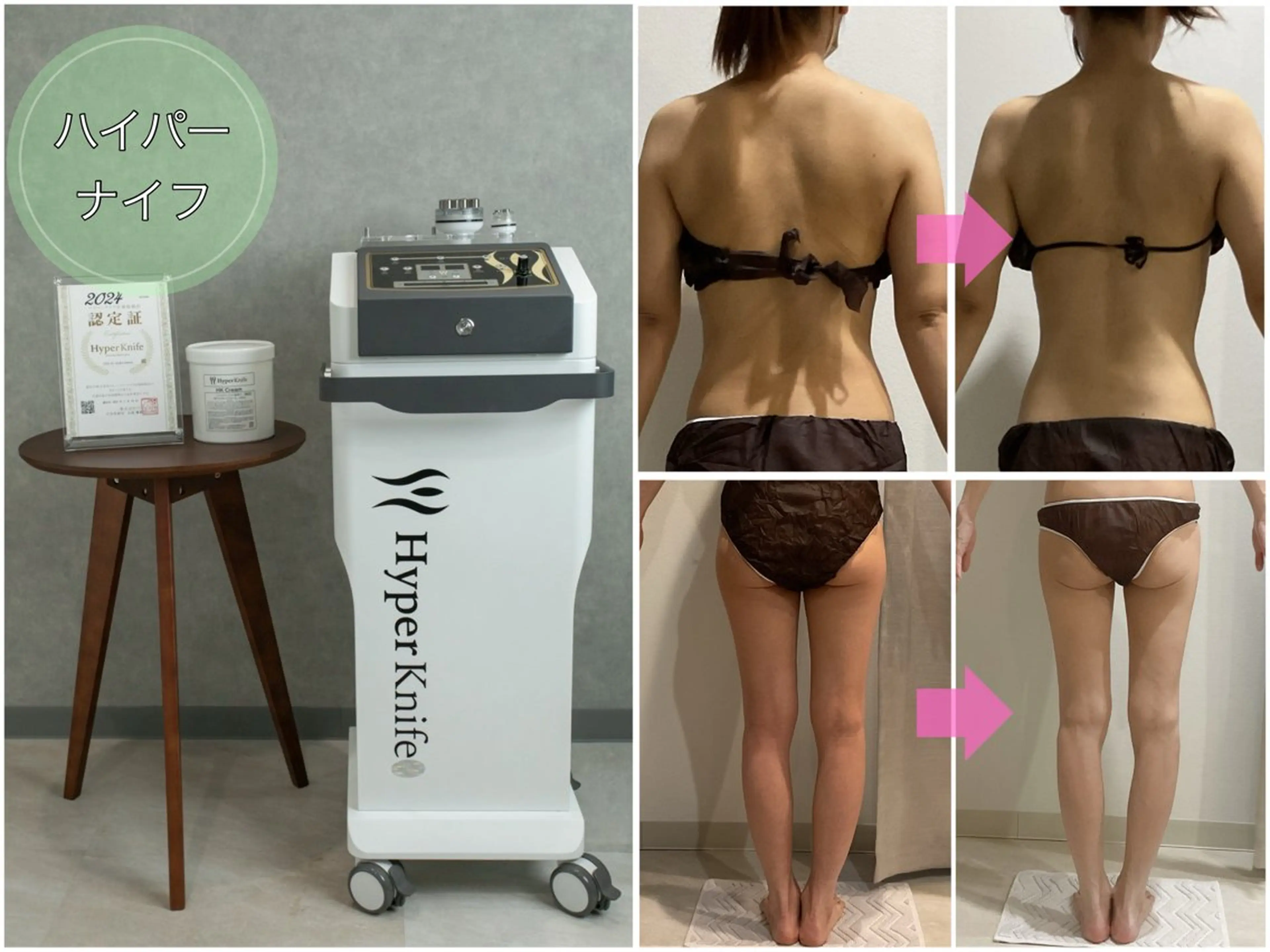 【1月限定】痩身モデル募集！の写真