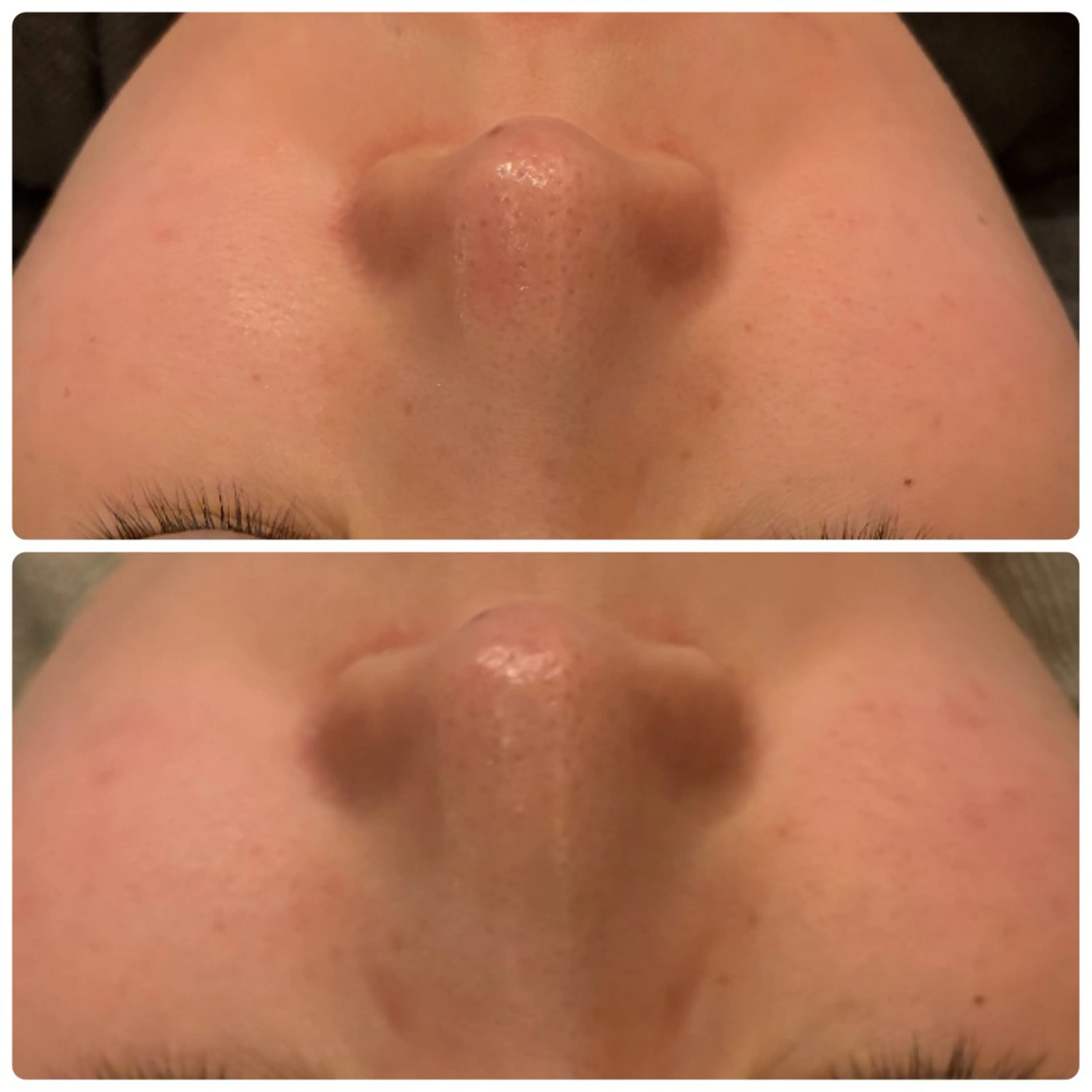 脱毛 yellow.所属・yellow💛【 脱毛&フェイシャル】のエステ・リラクイメージ