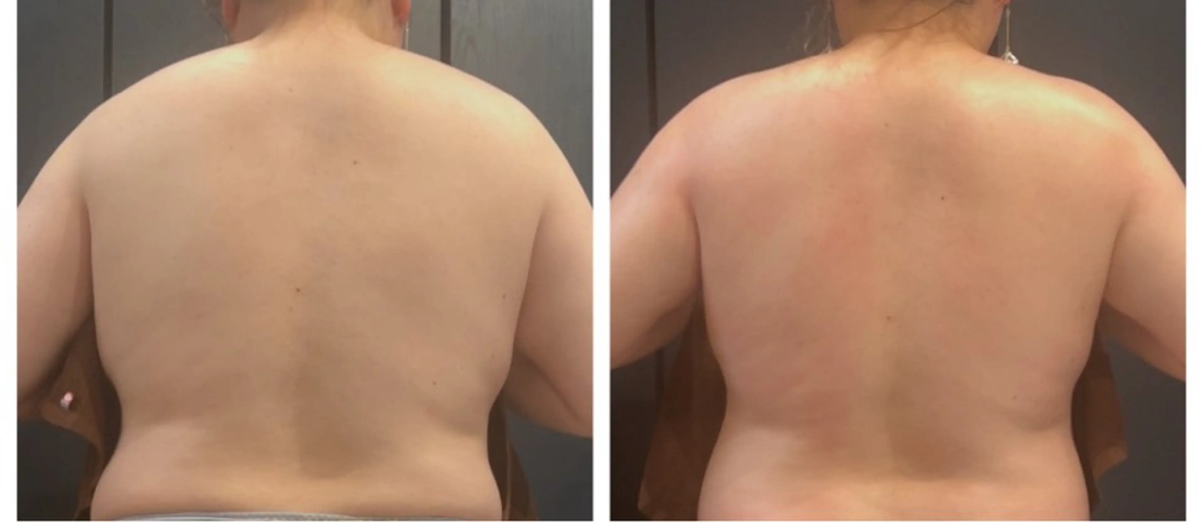 Alaia beau ty salonのエステ・リラクイメージ