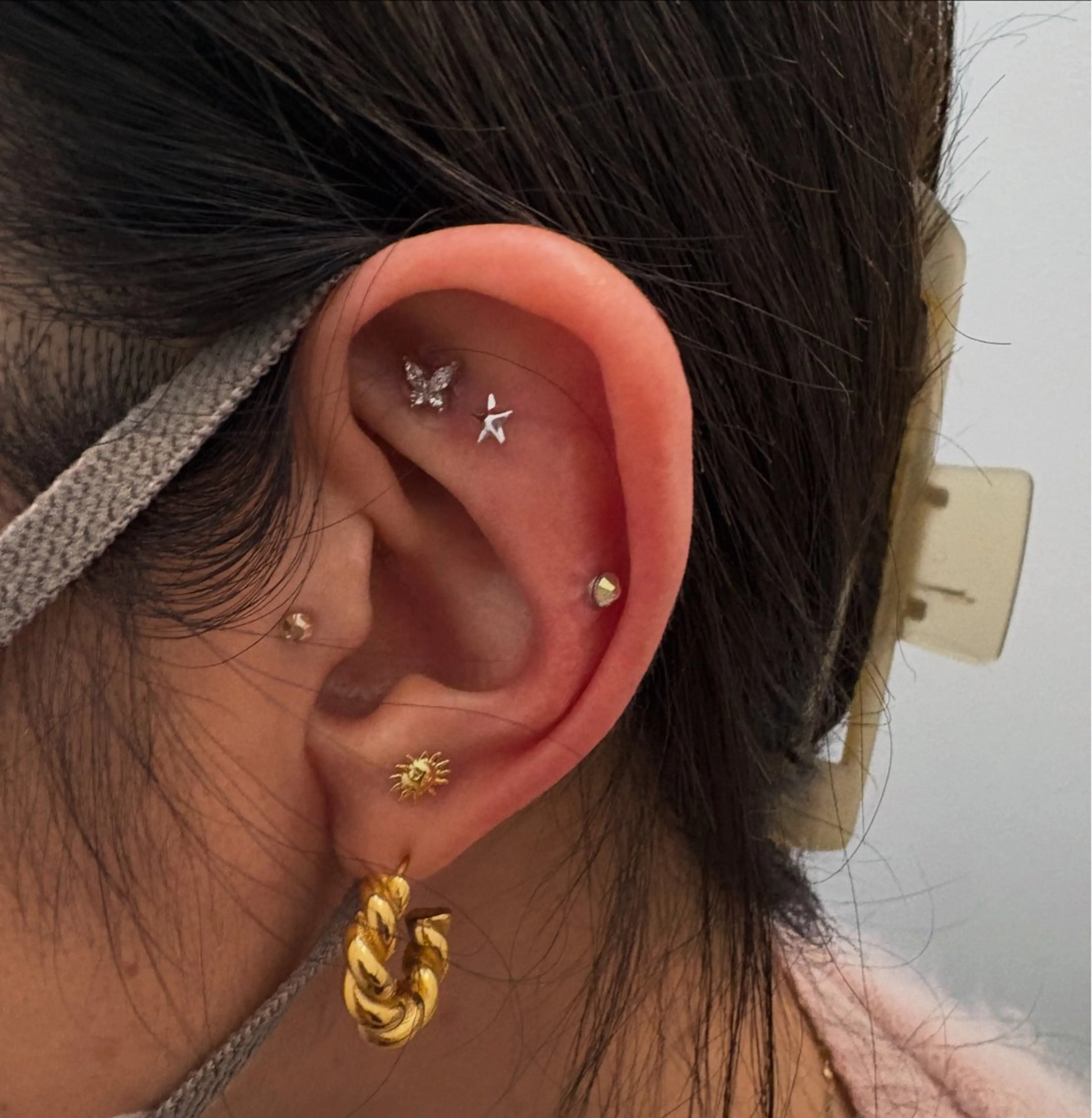 Miiju.所属・Miiju. 石巻市 脂肪冷却  鈴木のエステ・リラクイメージ