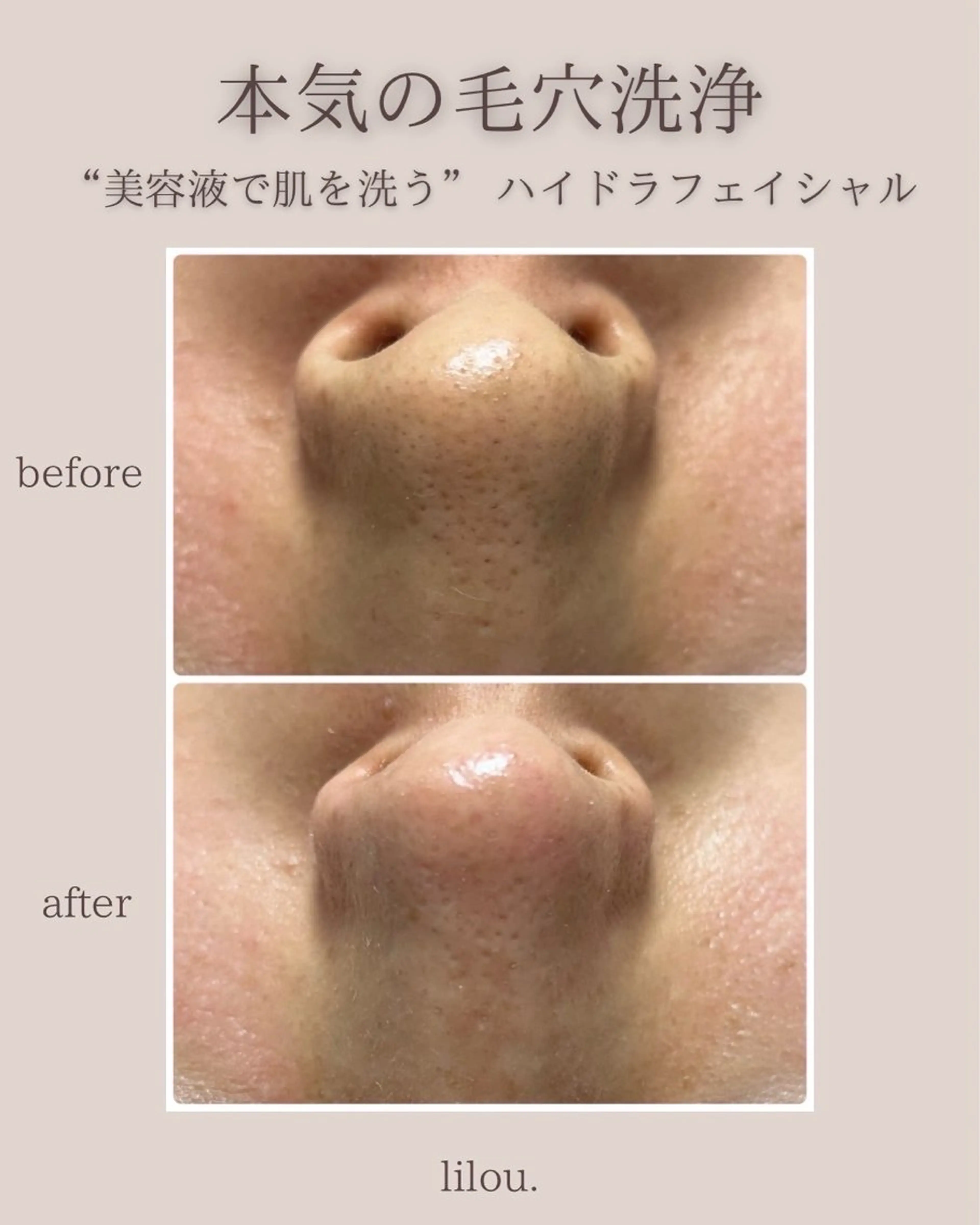 吉田 hue.のエステ・リラクイメージ