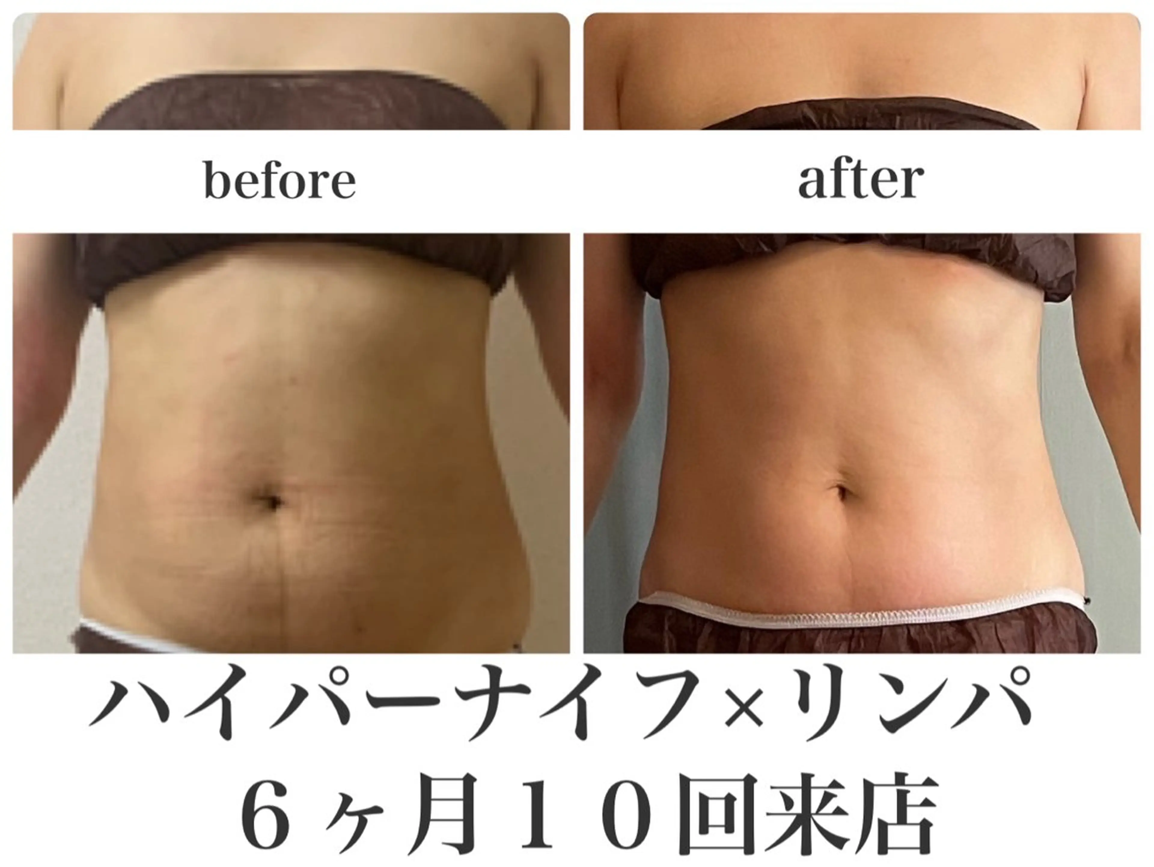 REME/リミー エステサロン東大宮店所属・小林 雪乃のエステ・リラクイメージ