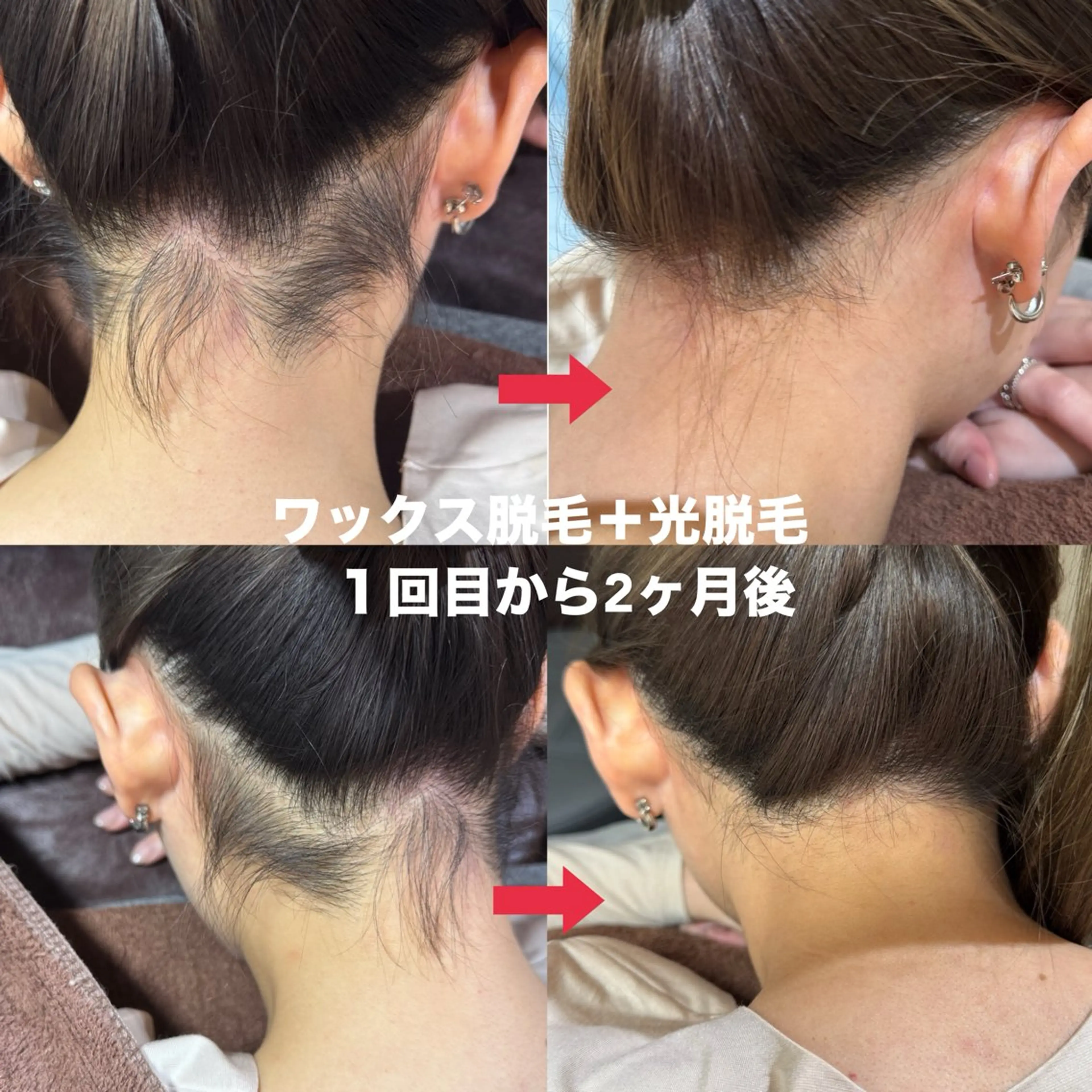 脱毛 ワックス脱毛サロン 🎀新宿駅徒歩5分のエステ・リラクイメージ