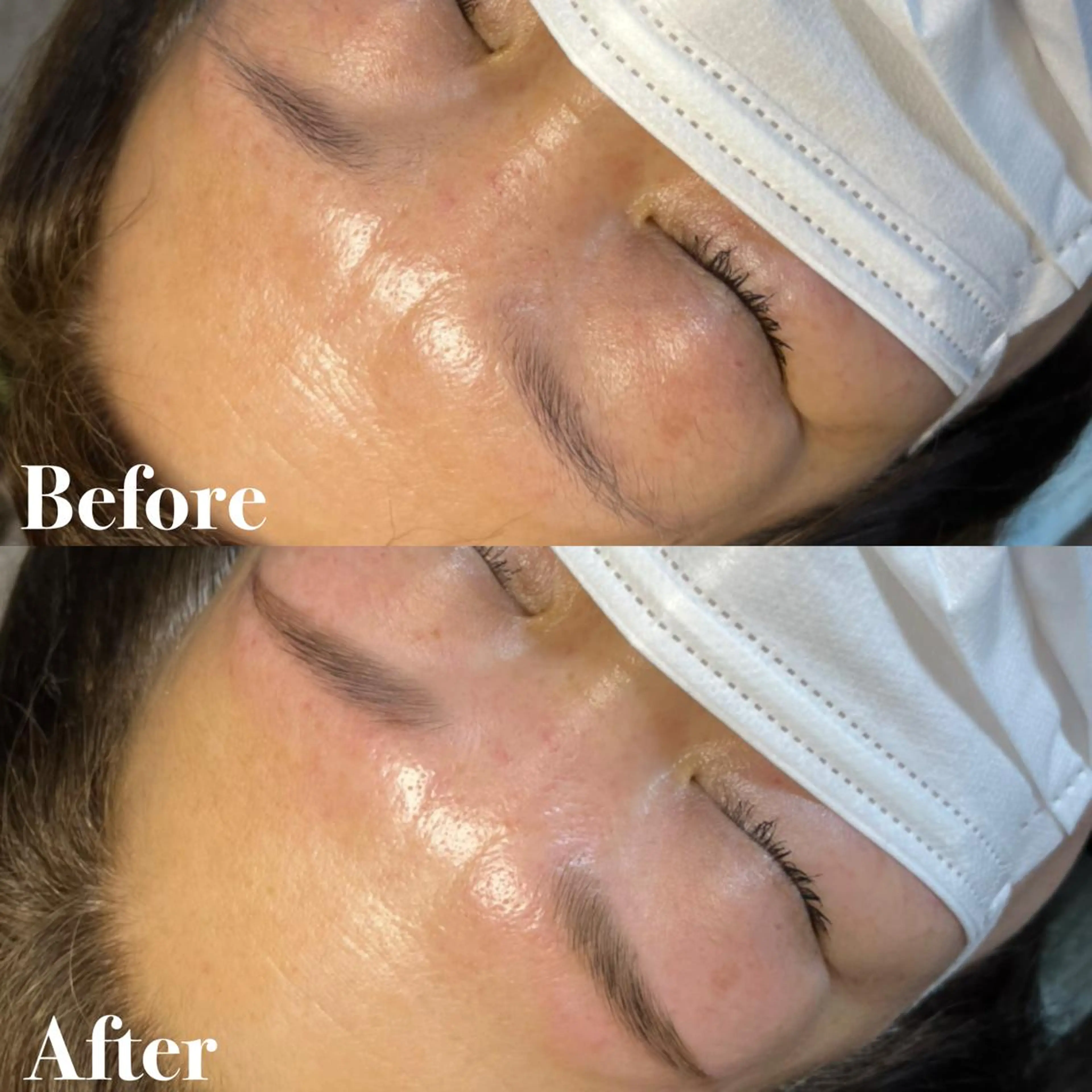 アイブロウ ハリウッドブロウリフト 眉毛と韓国肌質改善 サロン　和泉府中のエステ・リラクイメージ