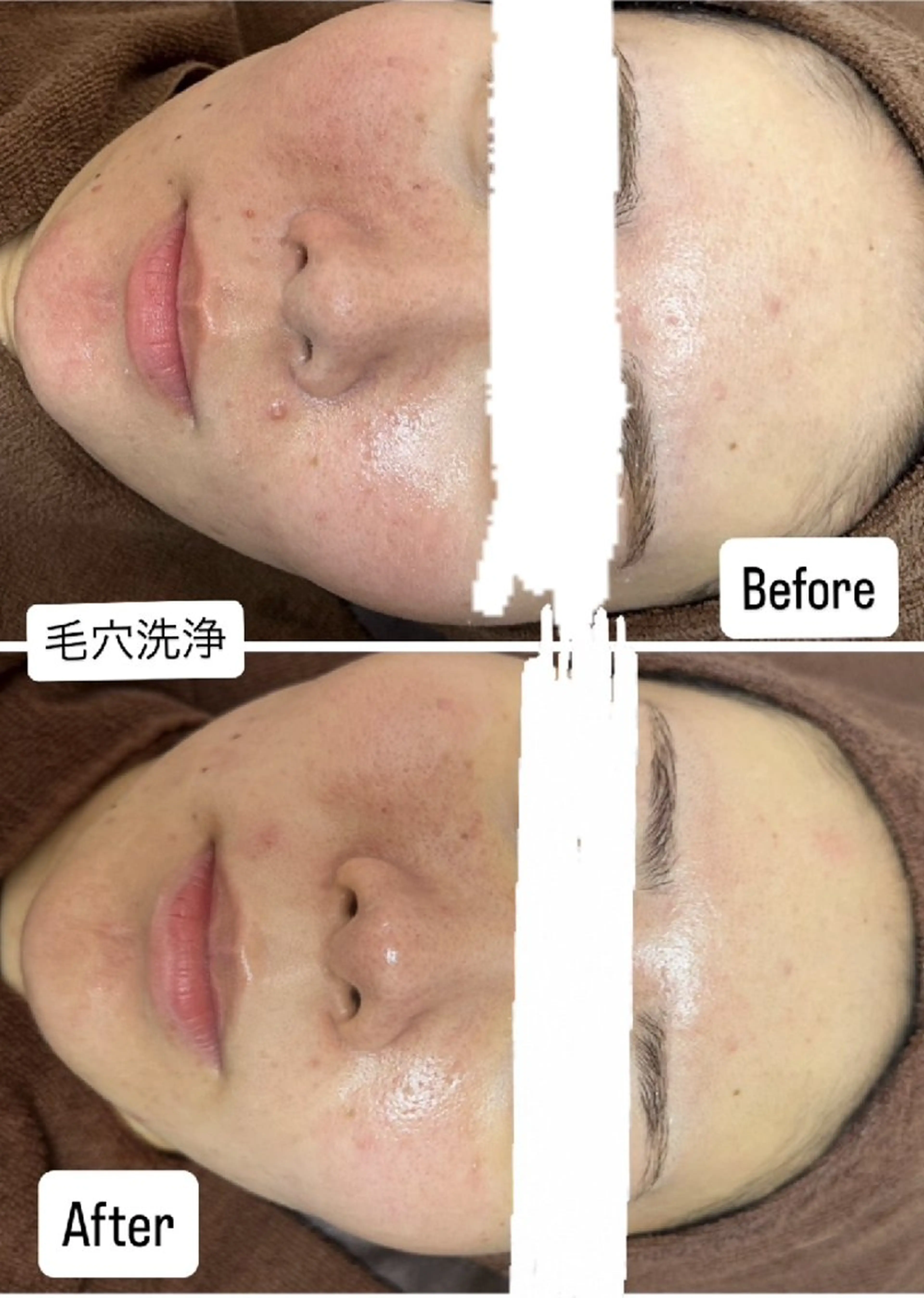 salon de off 御堂筋店所属・✨️韓国肌管理✨️ madokaのエステ・リラクイメージ