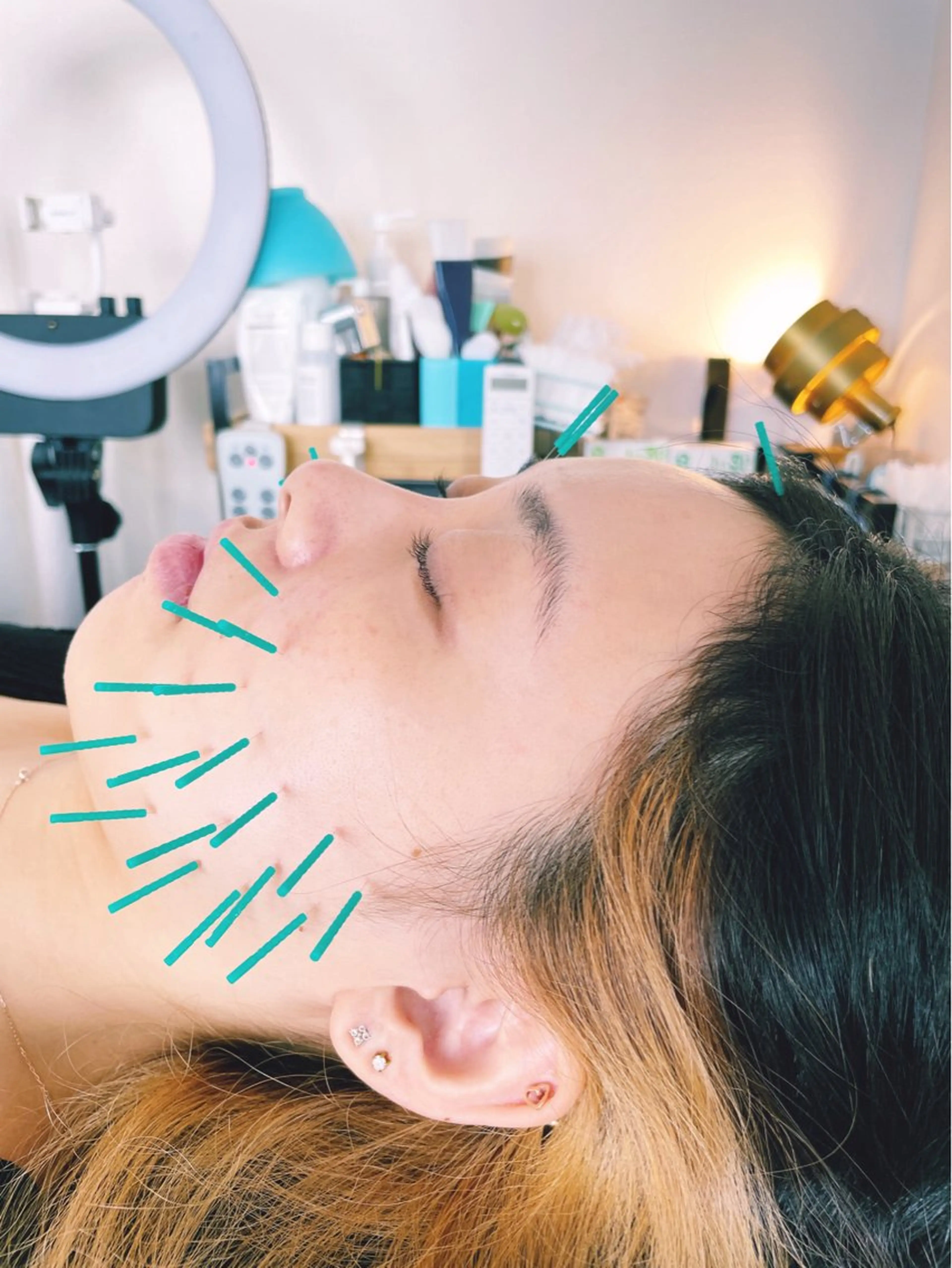 小顔美容鍼専門サロン 渋谷YZのエステ・リラクイメージ