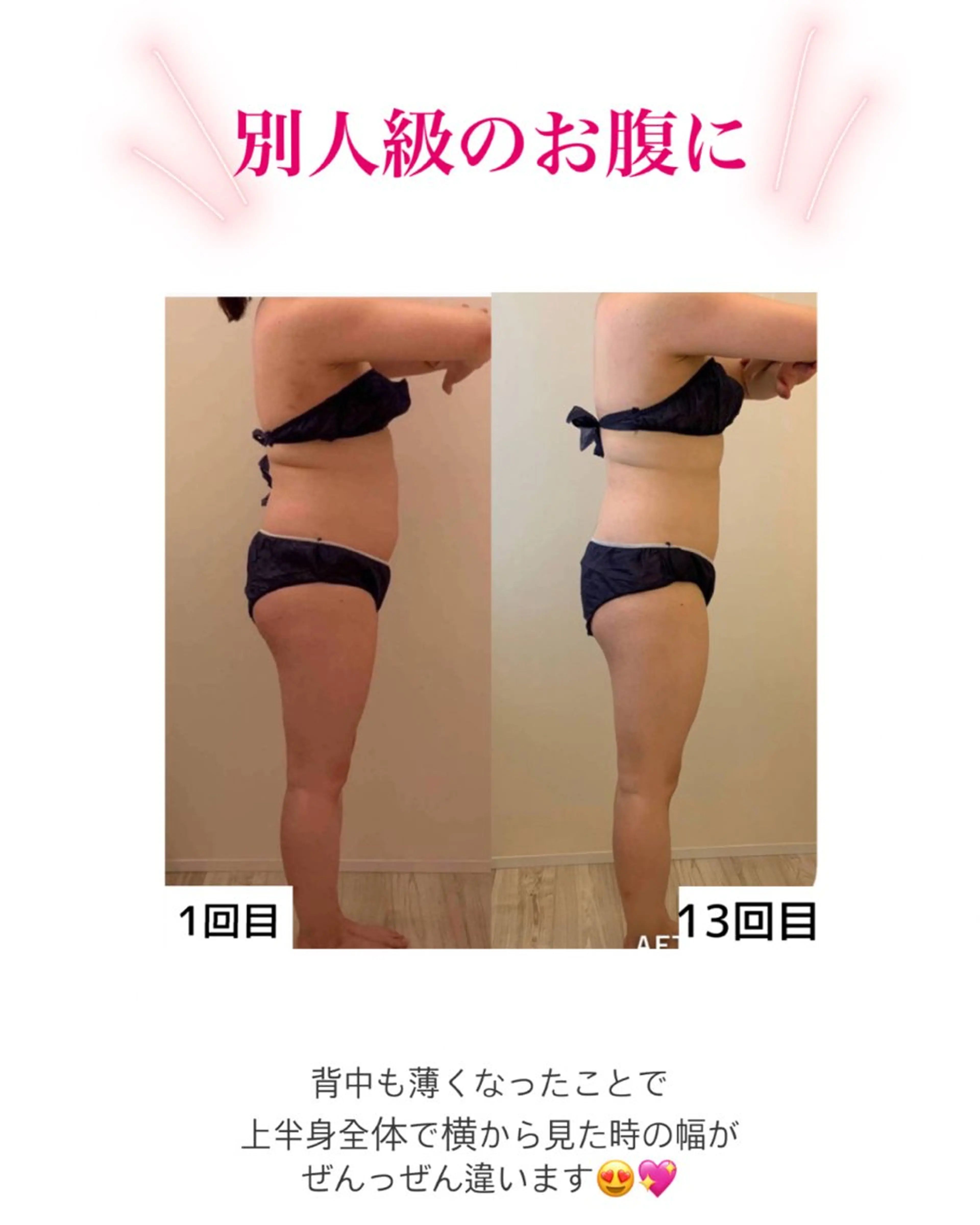産後ダイエット−9㎏ Pourvous結衣のエステ・リラクイメージ