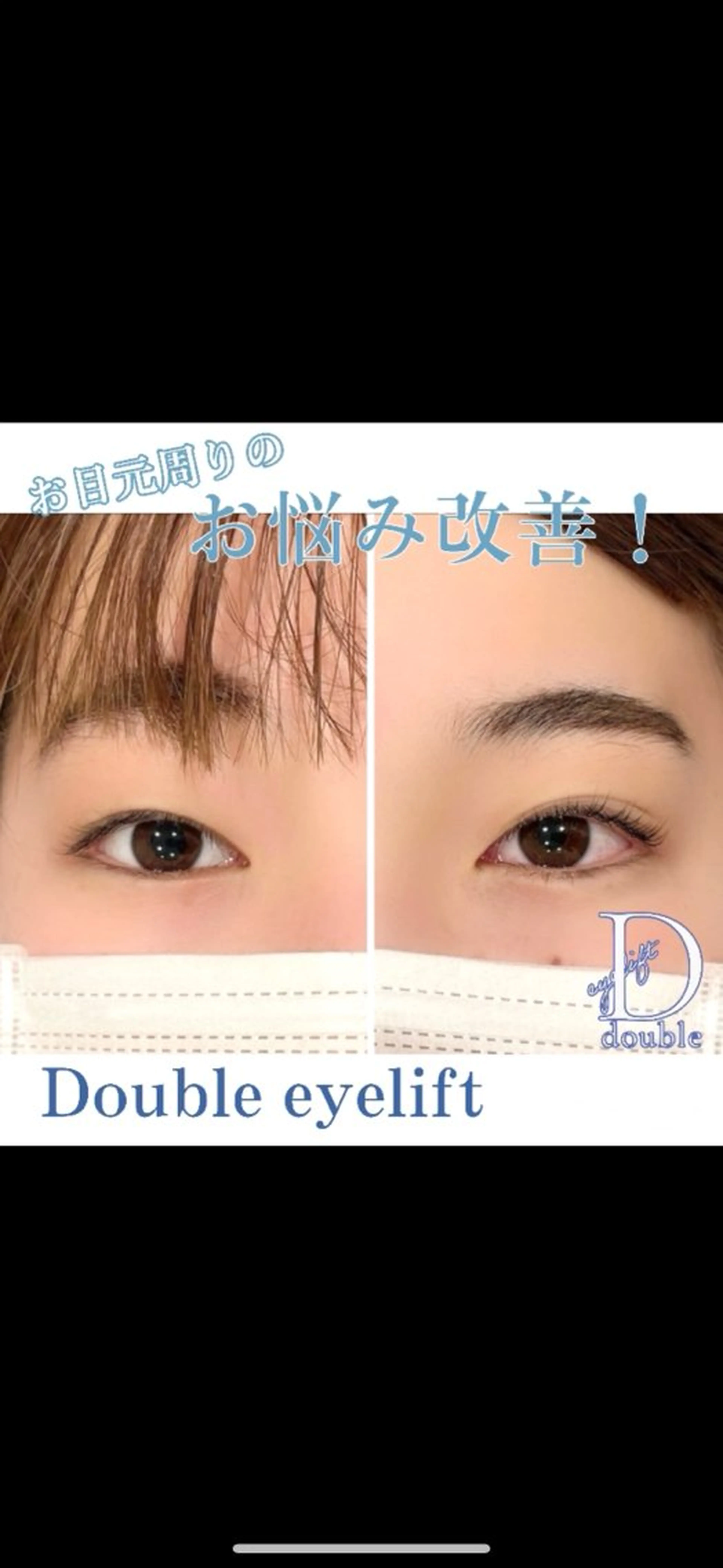 マツエク・マツパ まつげパーマ 🩵ANELA東口 齋藤琴音💚のマツエク・マツパデザイン